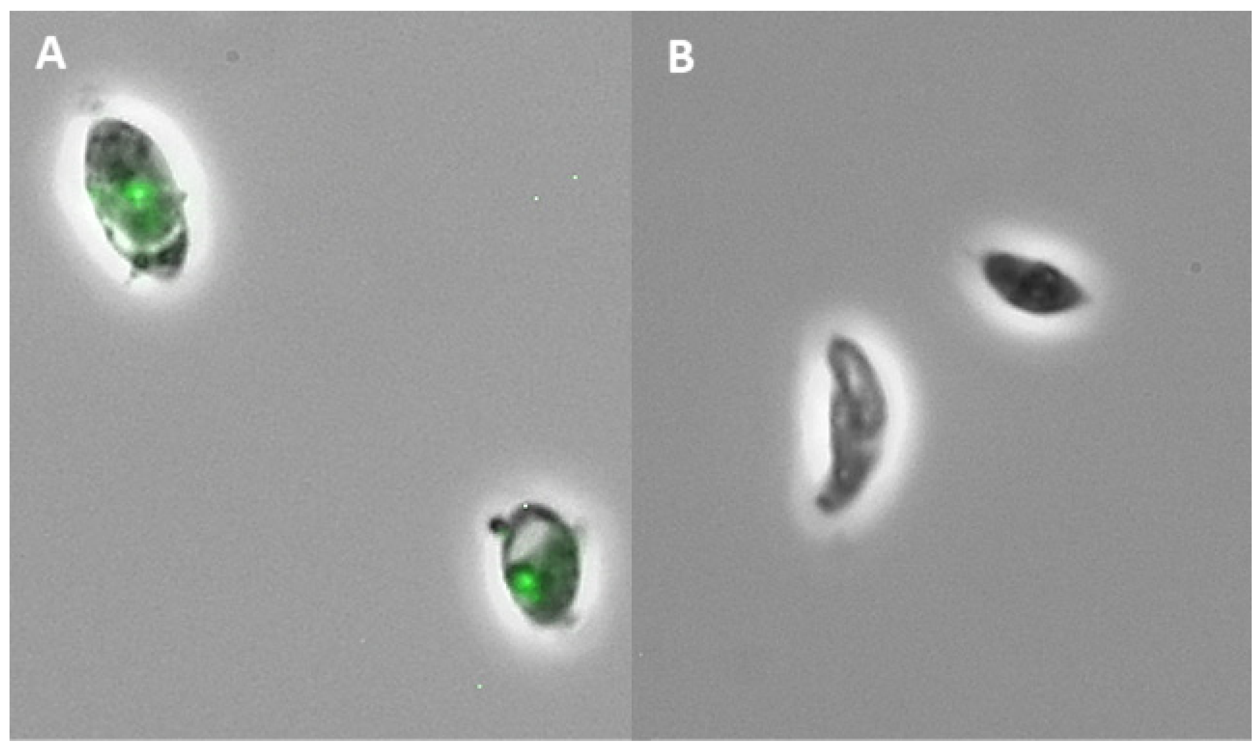 Antibiotics | Free Full-Text | Evaluation of the Anti-Toxoplasma gondii  Efficacy, Cytotoxicity, and GC/MS Profile of Pleopeltis crassinervata  Active Subfractions