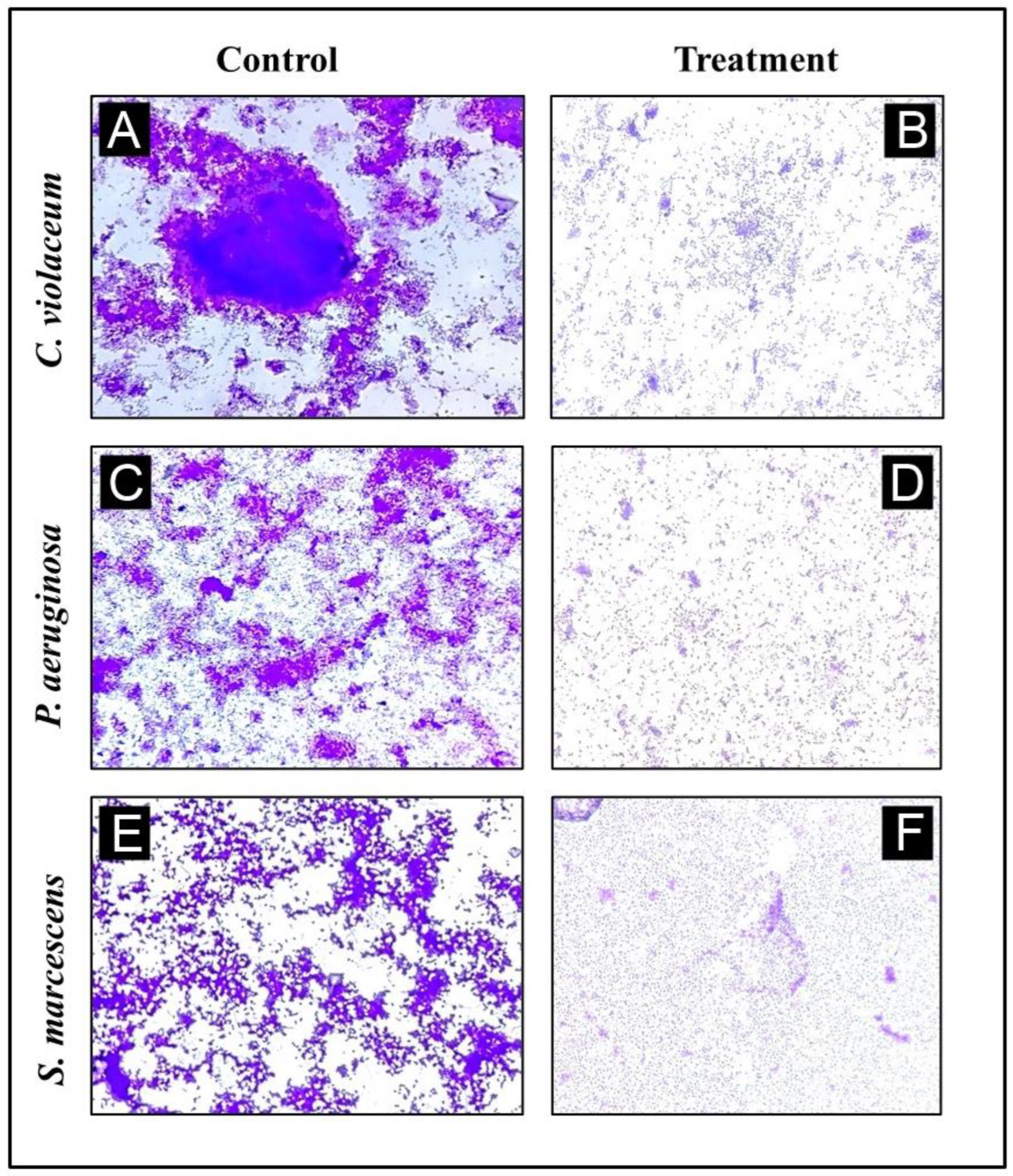 Antibiotics 12 00986 g008 Antibiotics 12 00986 g008