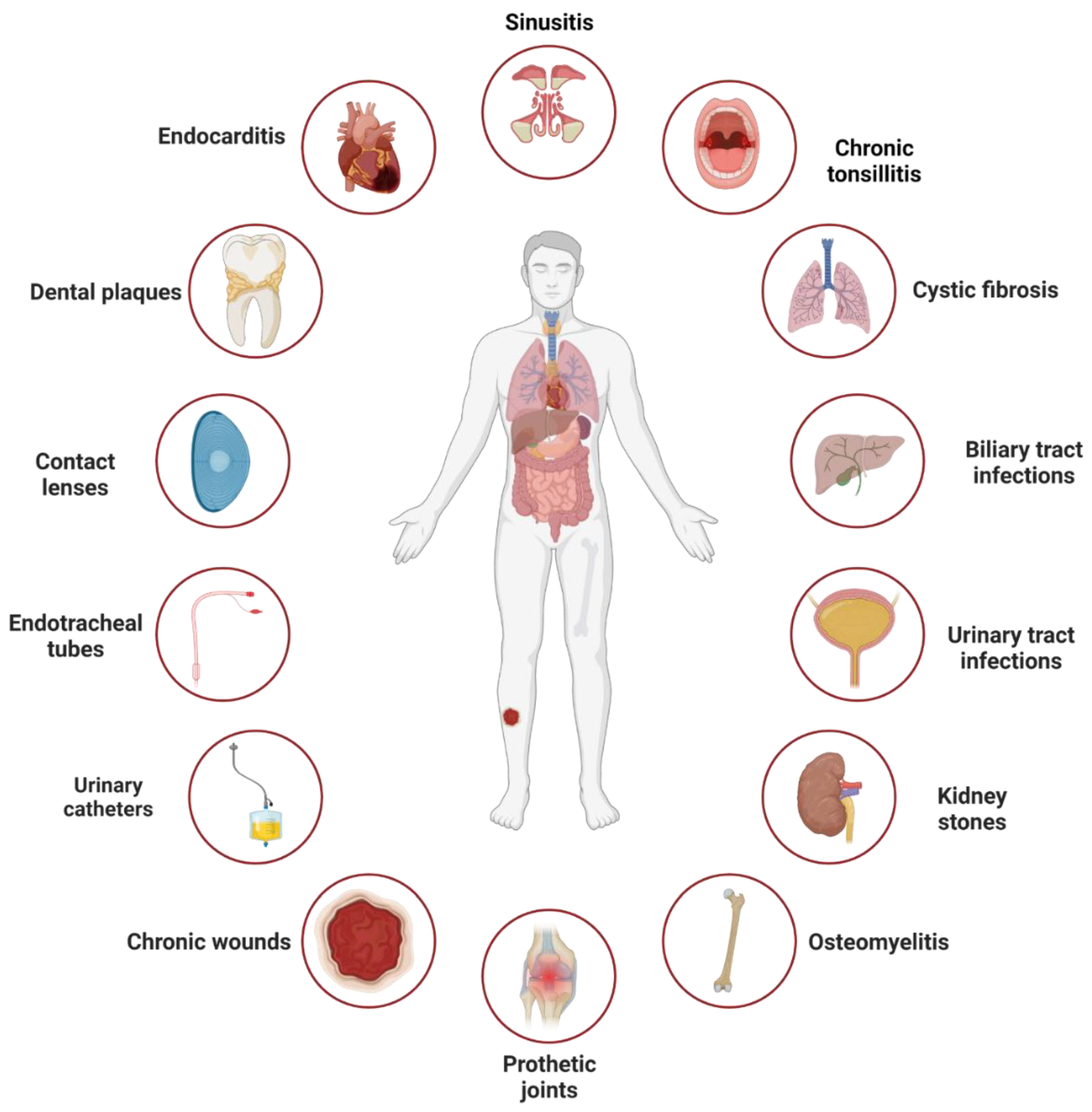 Evolving biofilm inhibition and eradication in clinical settings