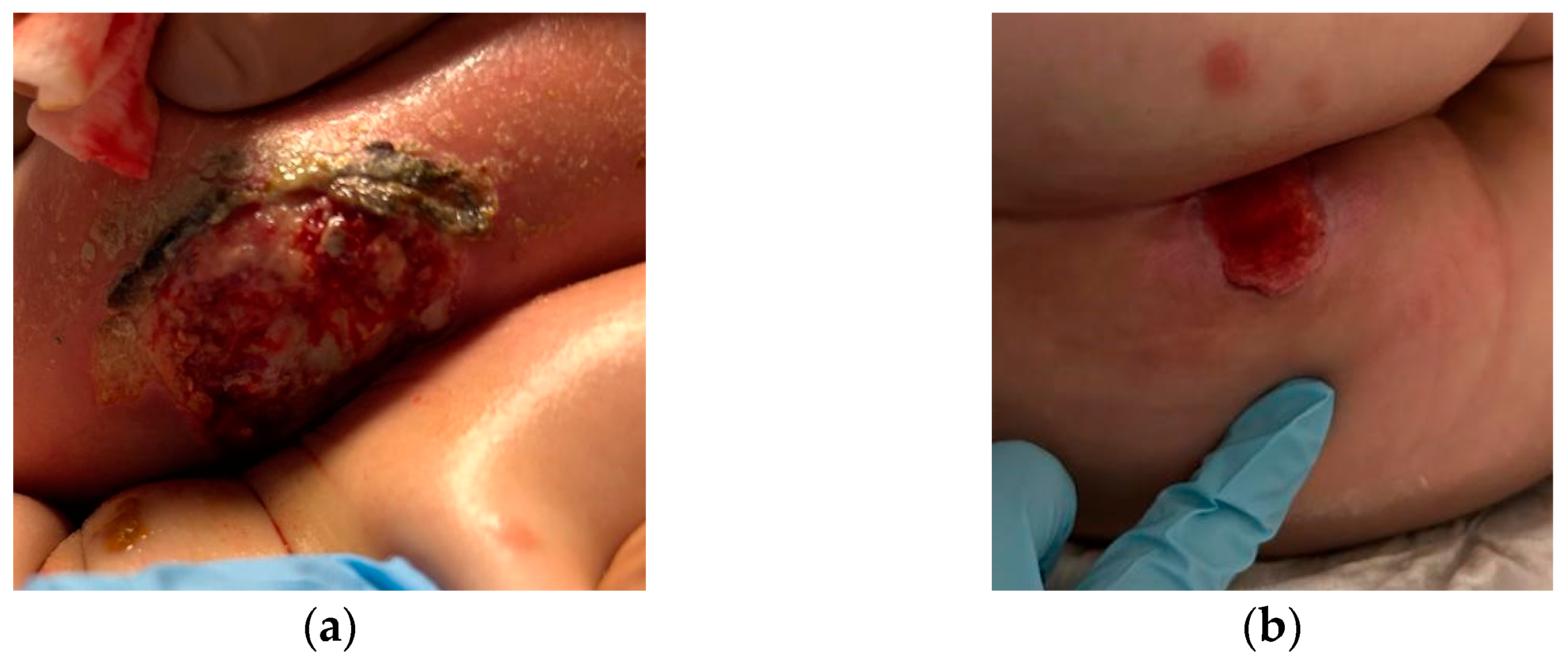 Antibiotics 12 01033 g001