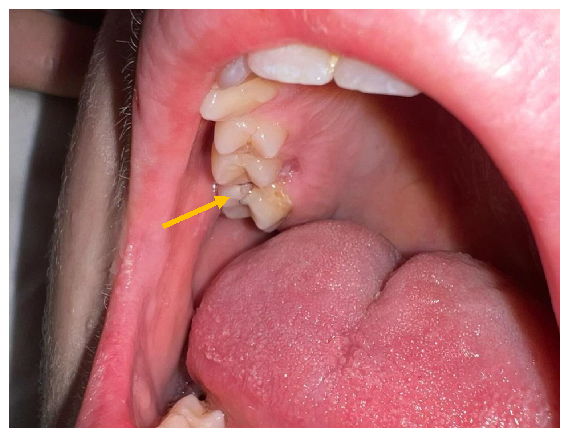 Antibiotics 12 01222 g001 Antibiotics 12 01222 g001