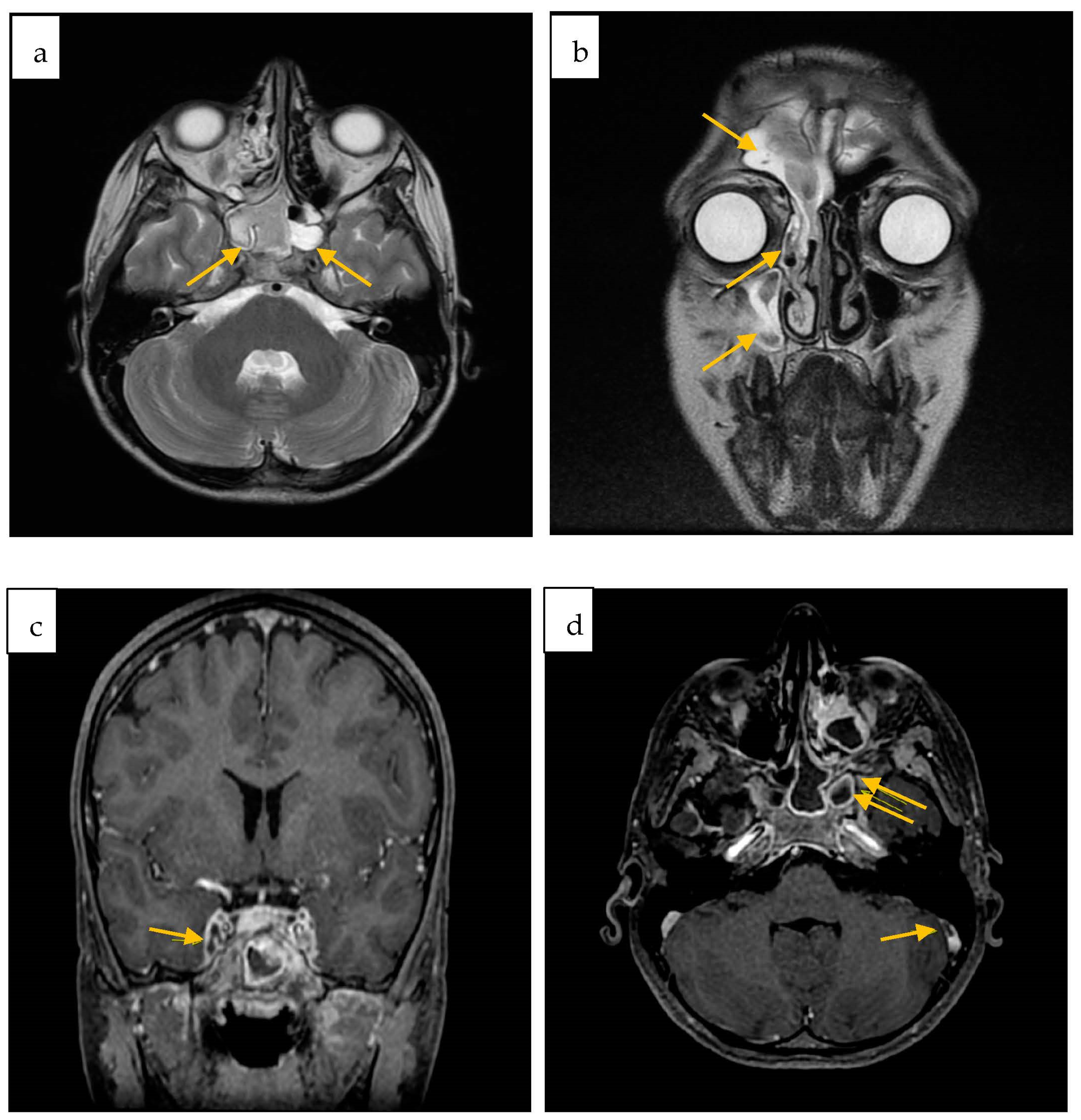 Antibiotics 12 01222 g002 Antibiotics 12 01222 g002