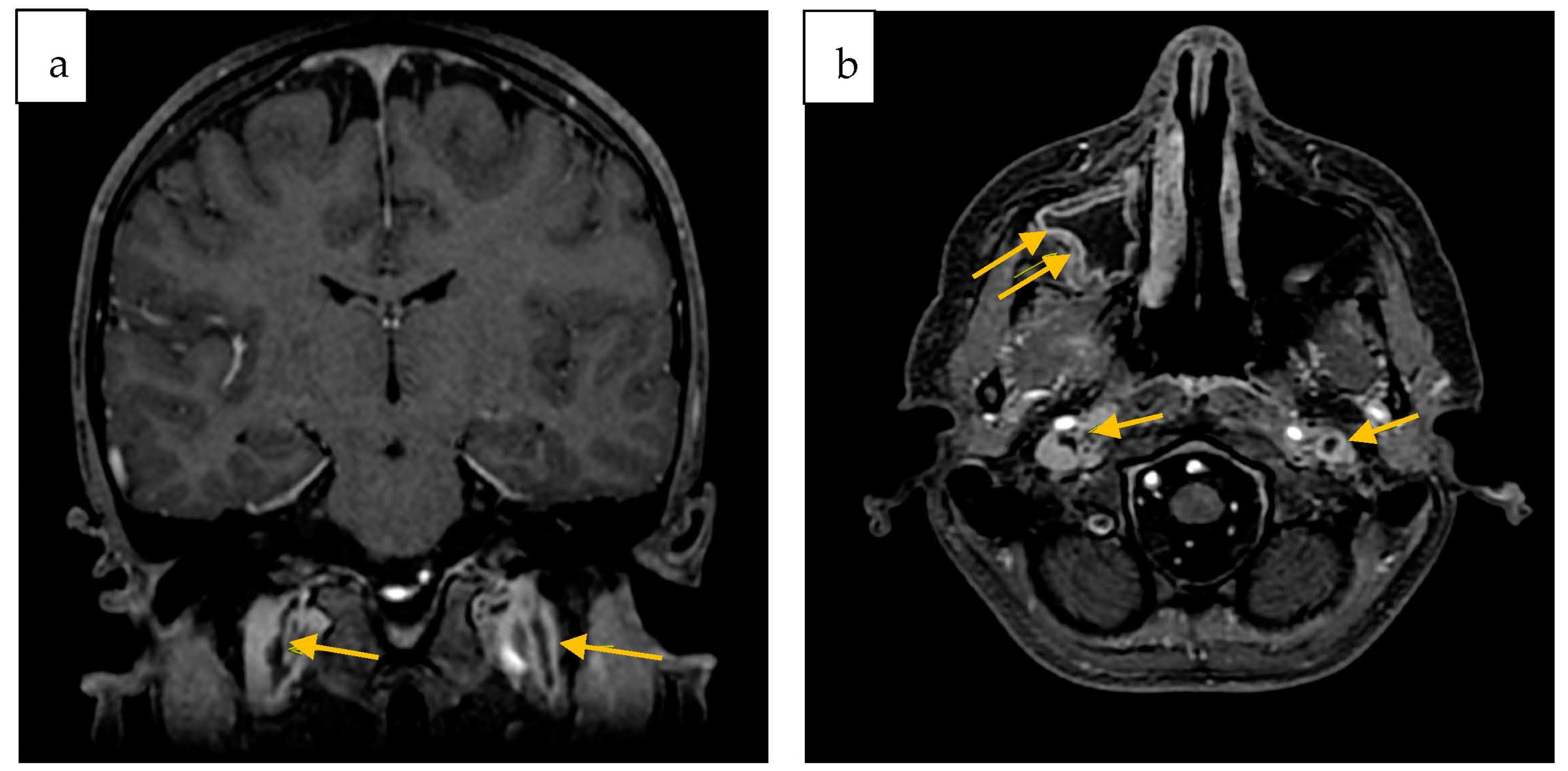 Antibiotics 12 01222 g003 Antibiotics 12 01222 g003