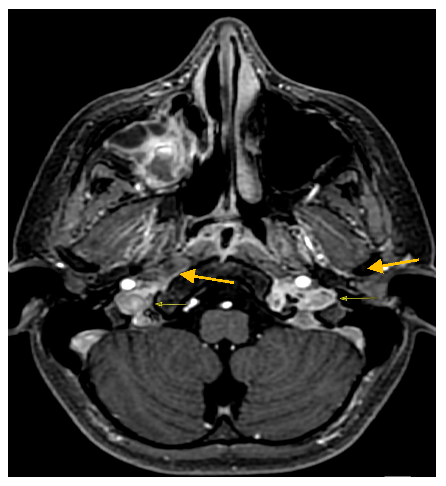 Antibiotics 12 01222 g004 Antibiotics 12 01222 g004