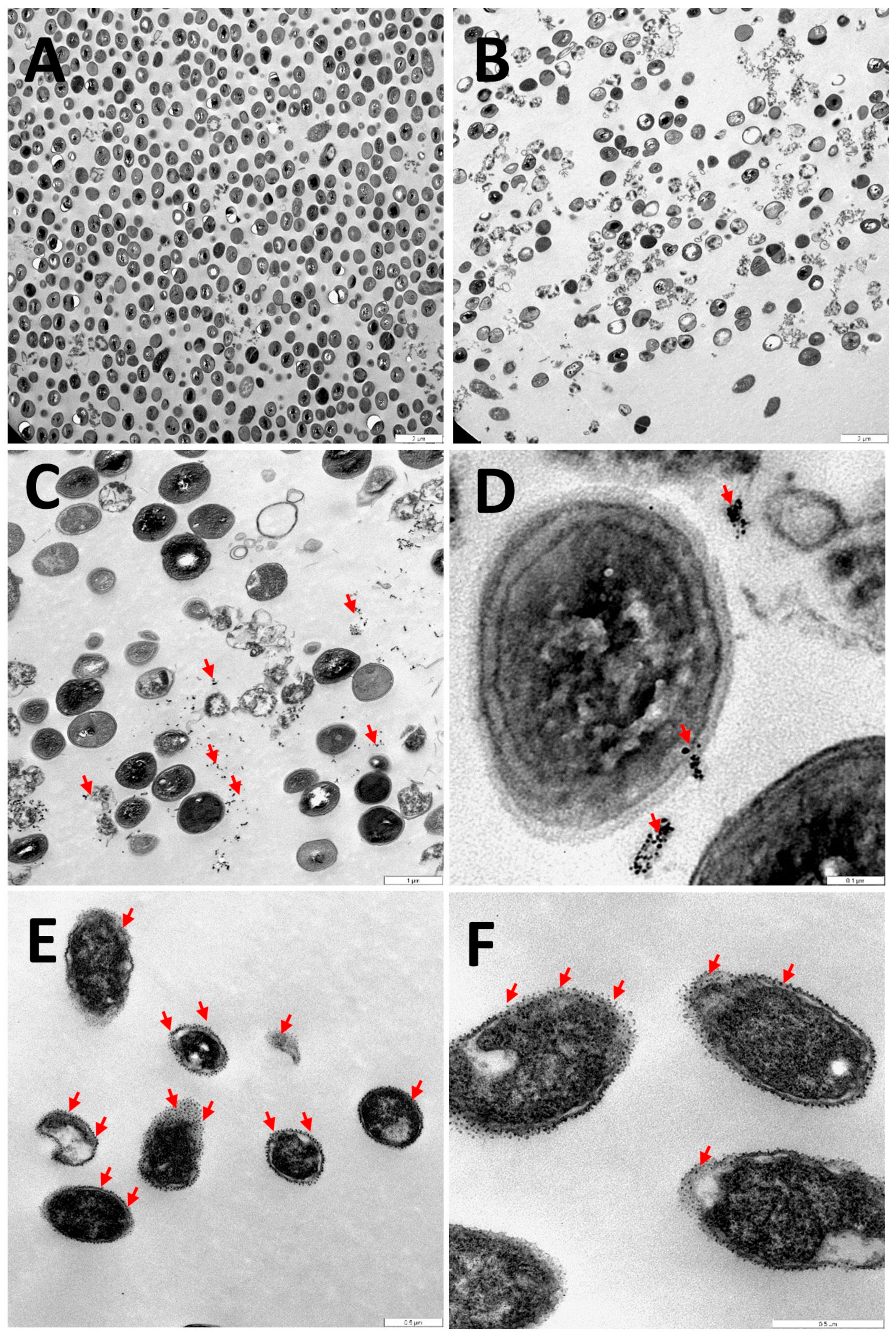 Antibiotics 12 01275 g012 Antibiotics 12 01275 g012