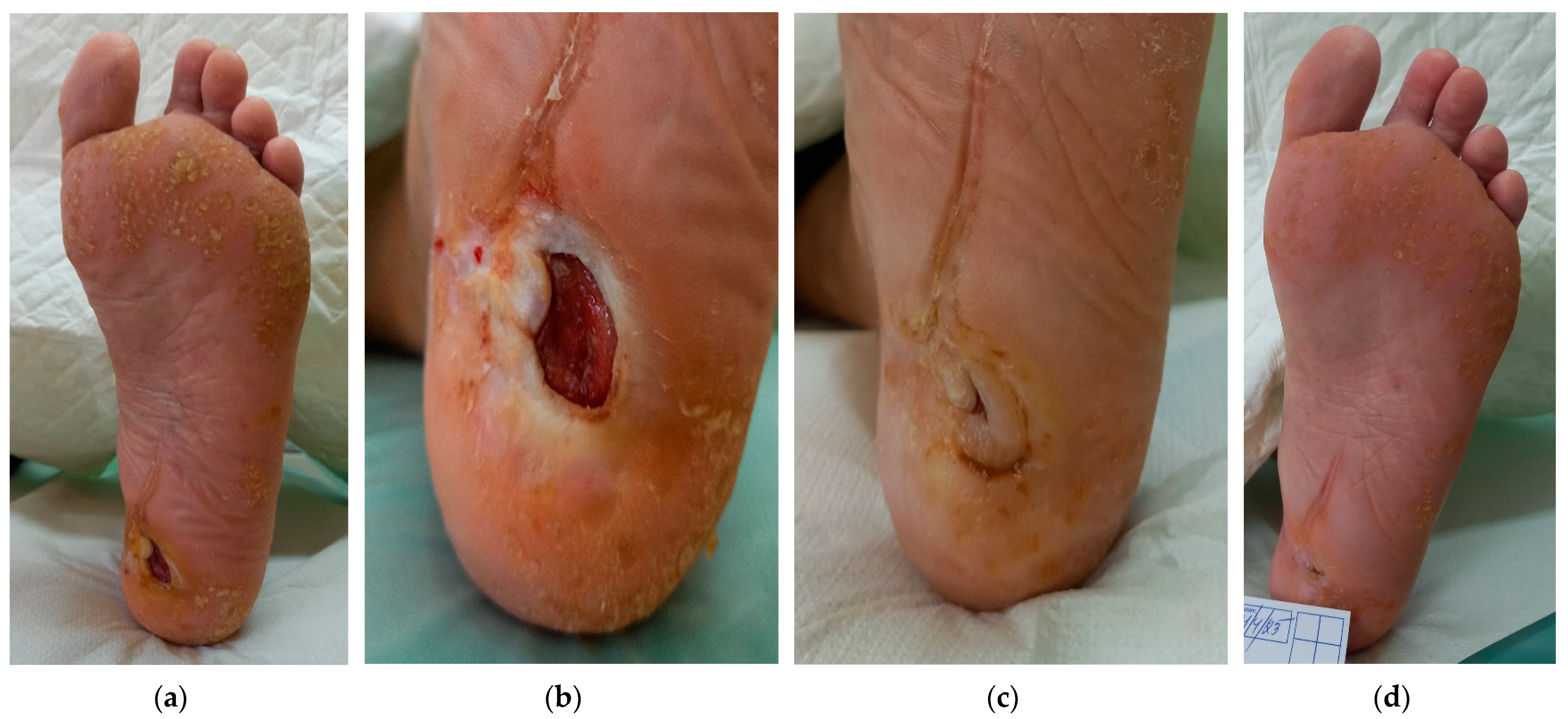 Antibiotics 12 01364 g004