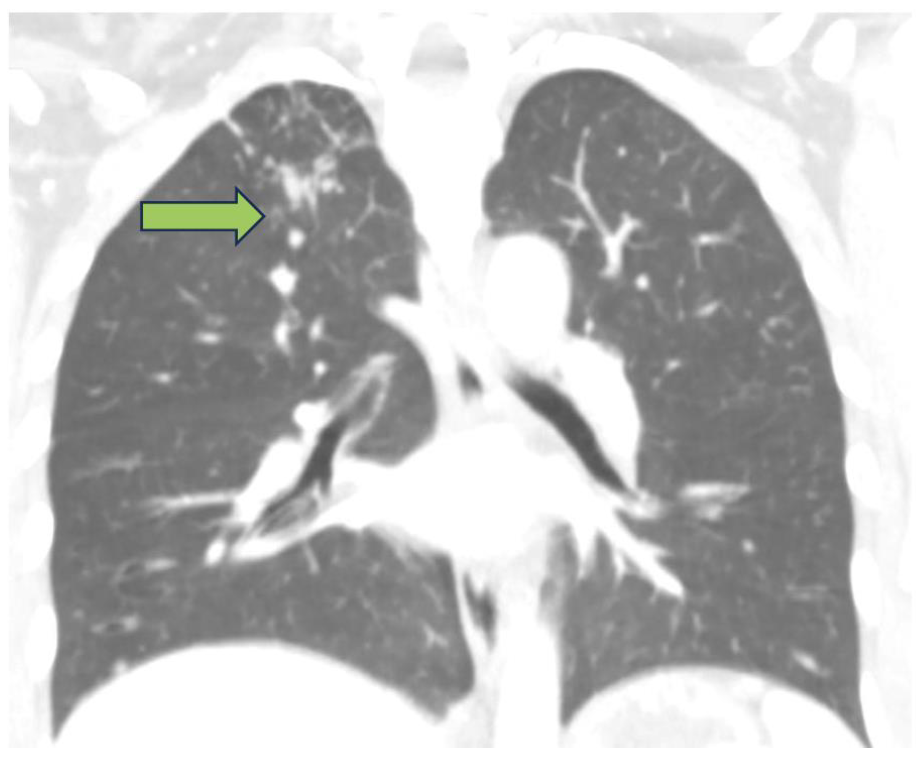 Antibiotics 12 01655 g001a