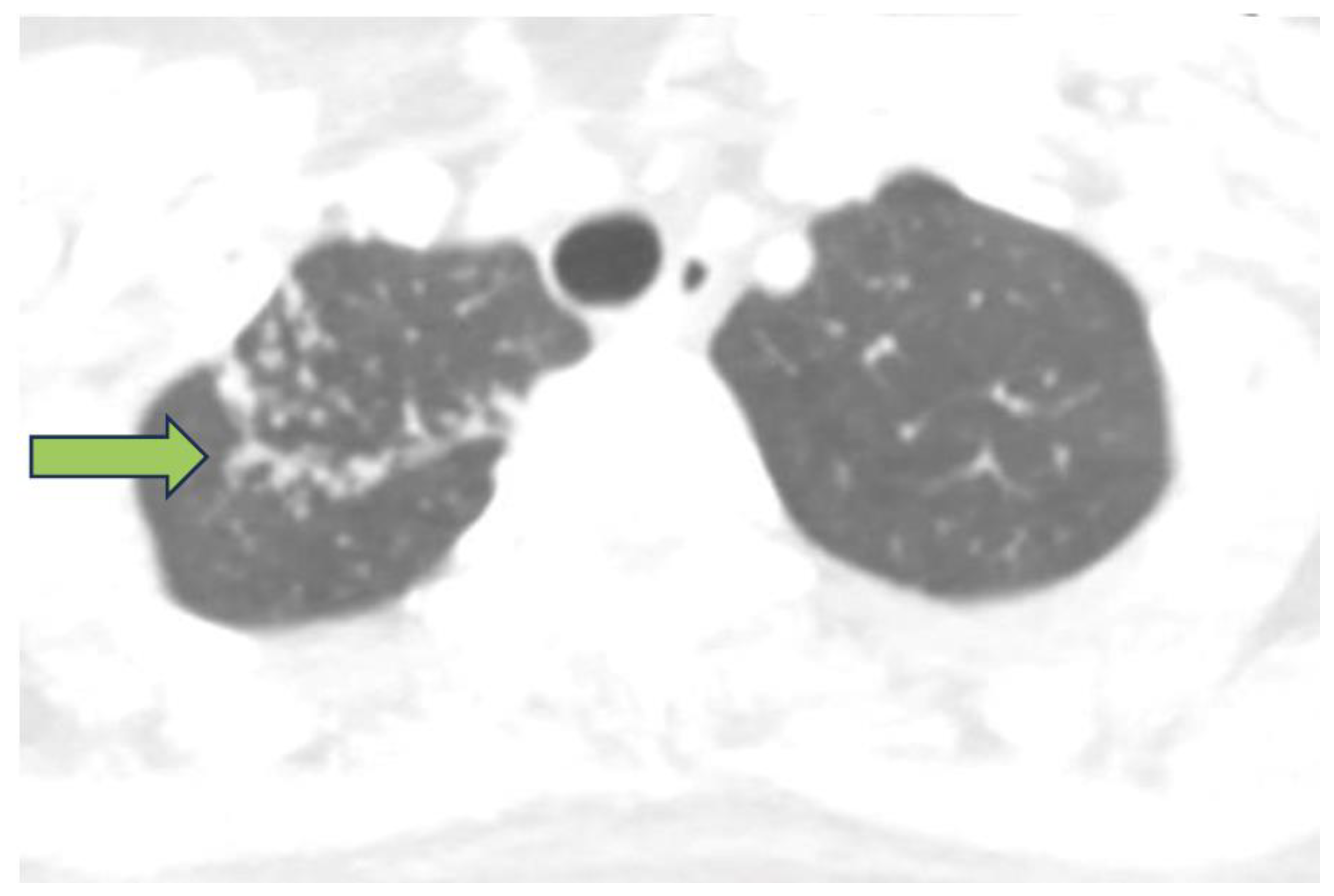 Antibiotics 12 01655 g001b