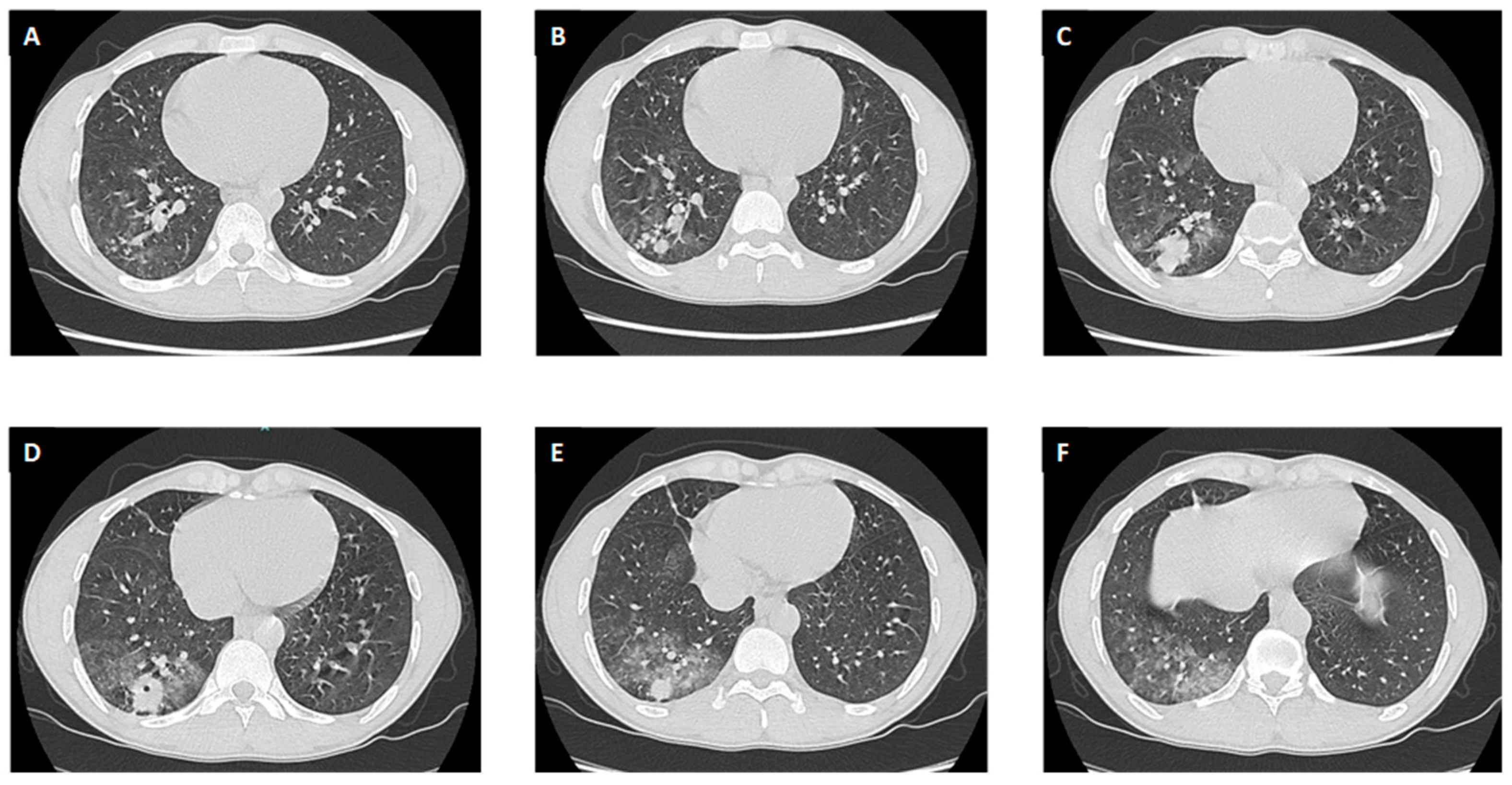 Antibiotics 12 01733 g001 Antibiotics 12 01733 g001