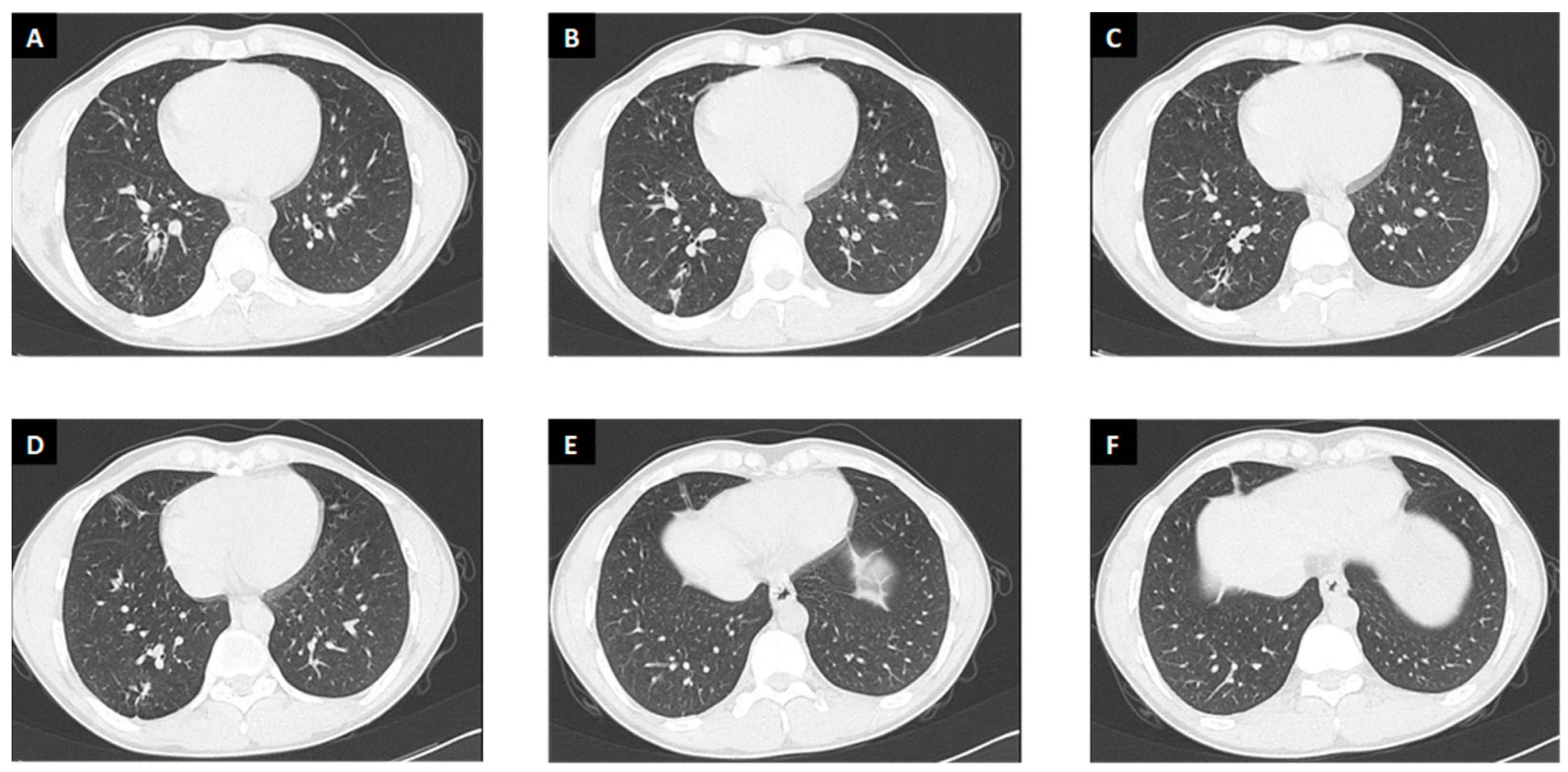 Antibiotics 12 01733 g002 Antibiotics 12 01733 g002