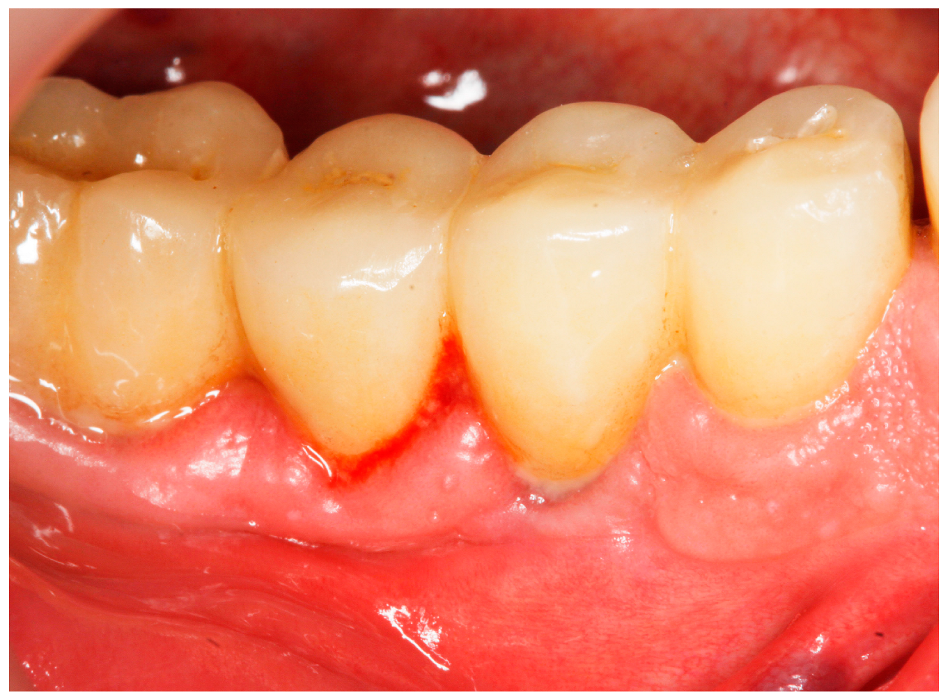 Antibiotics 13 00269 g001 Antibiotics 13 00269 g001