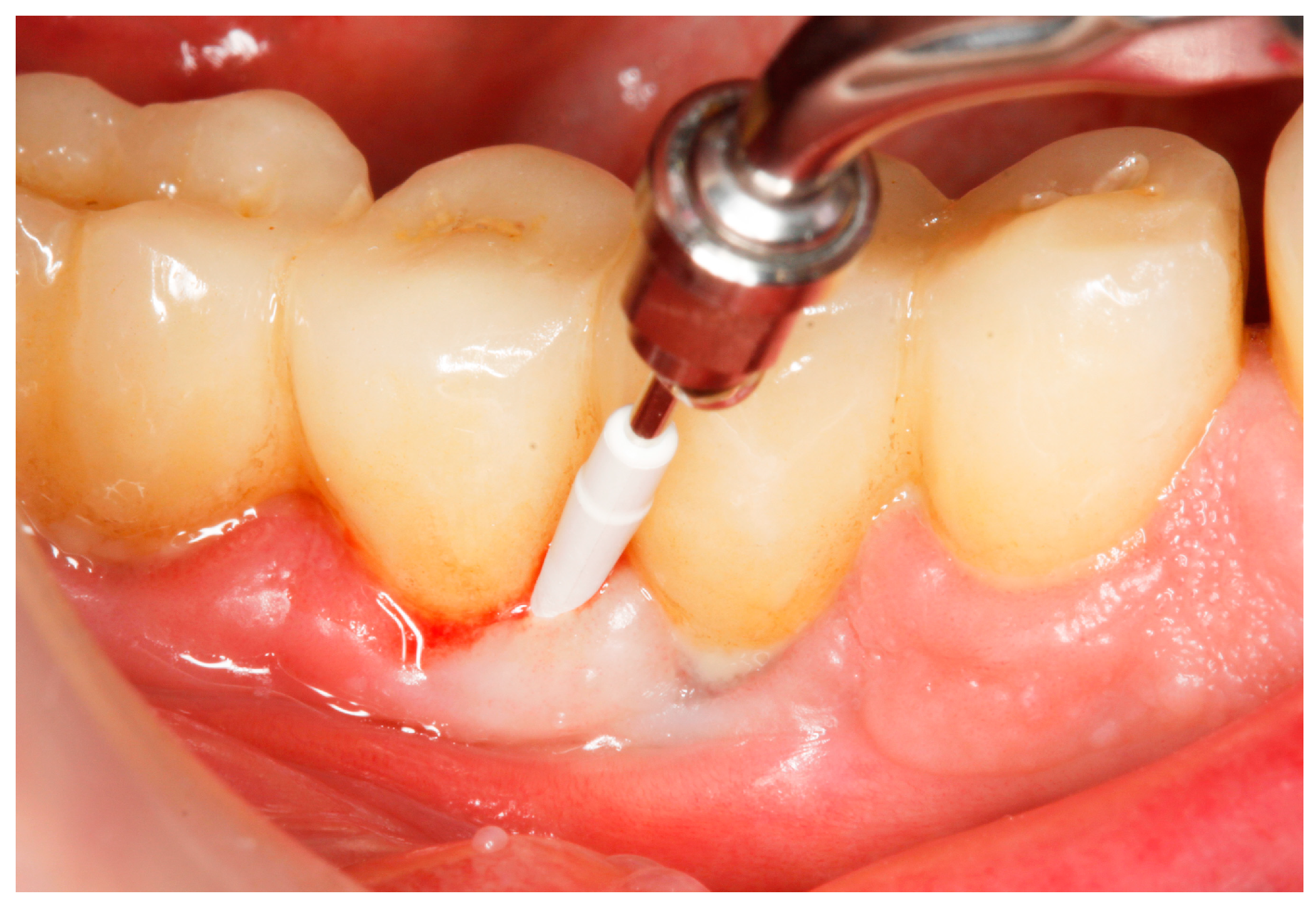 Antibiotics 13 00269 g003 Antibiotics 13 00269 g003