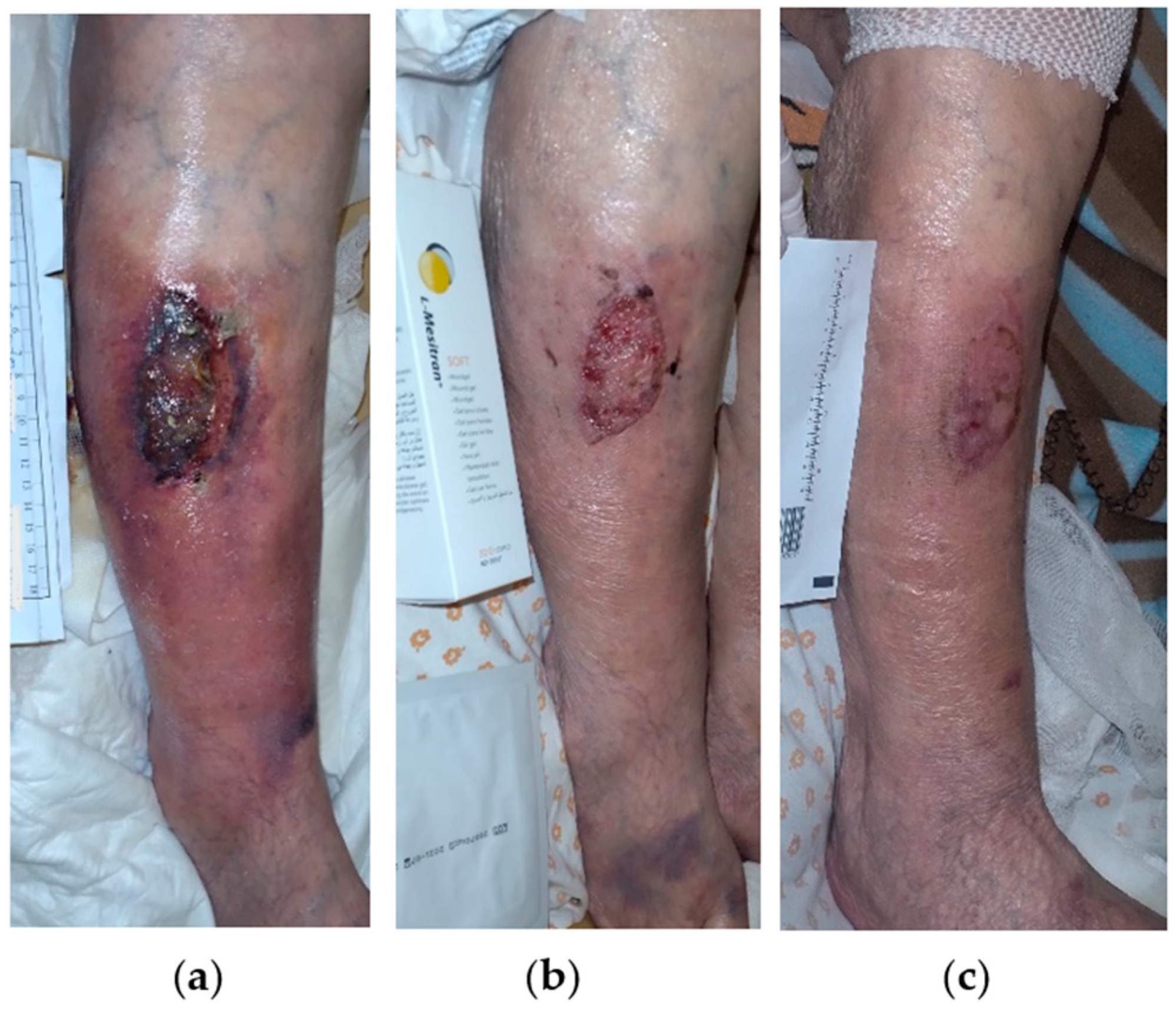 Antibiotics 13 00614 g004