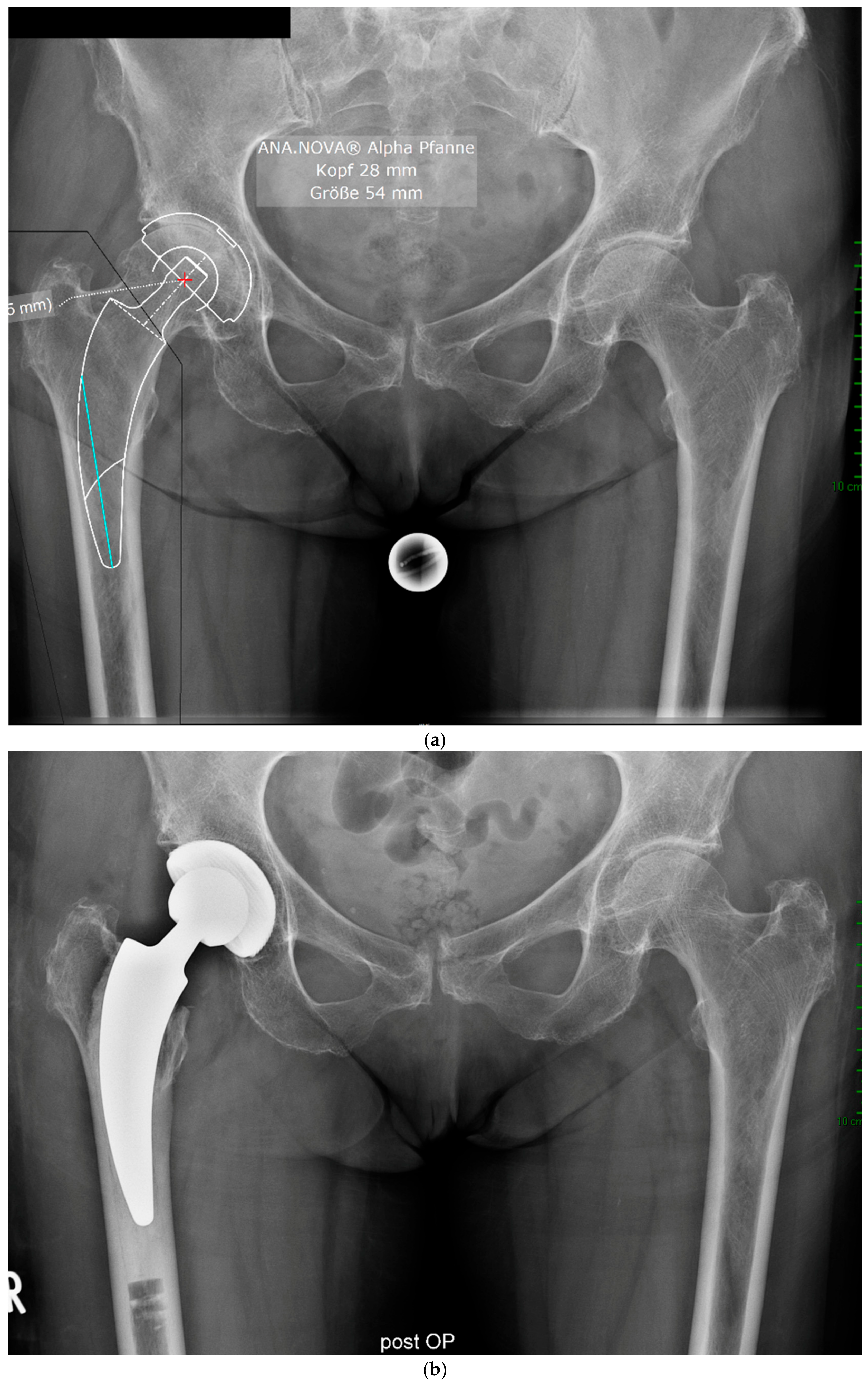 Antibiotics 13 00739 g002a