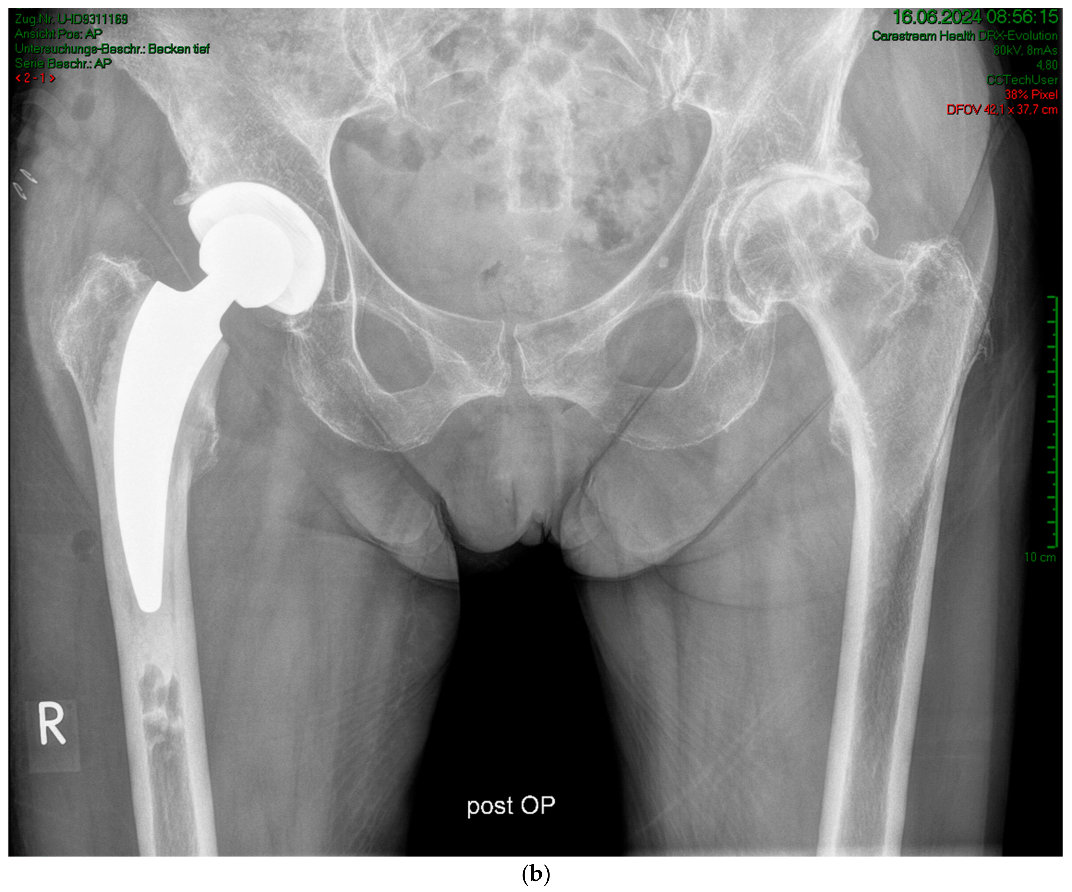 Antibiotics 13 00739 g004b