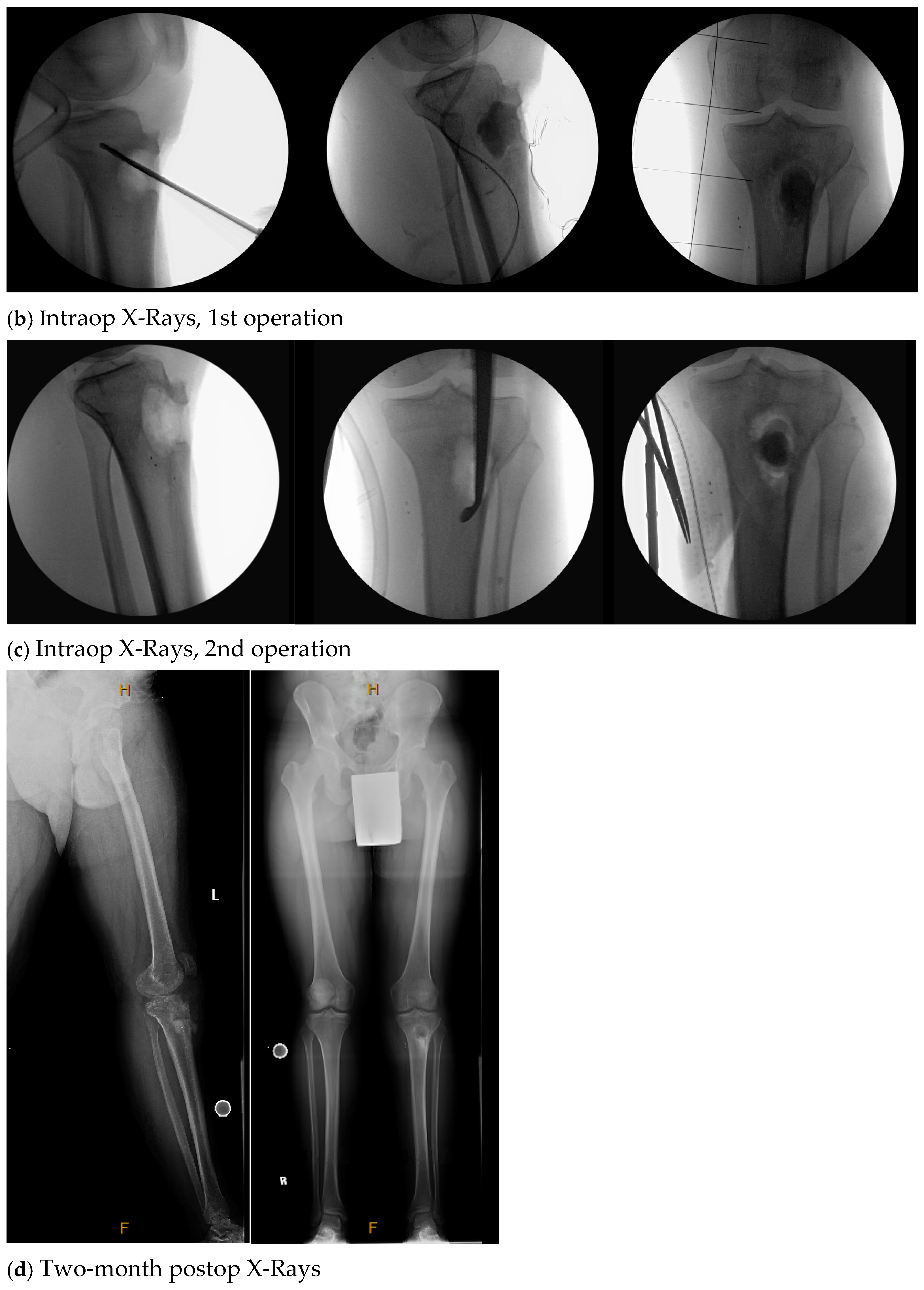 Antibiotics 13 01068 g001b