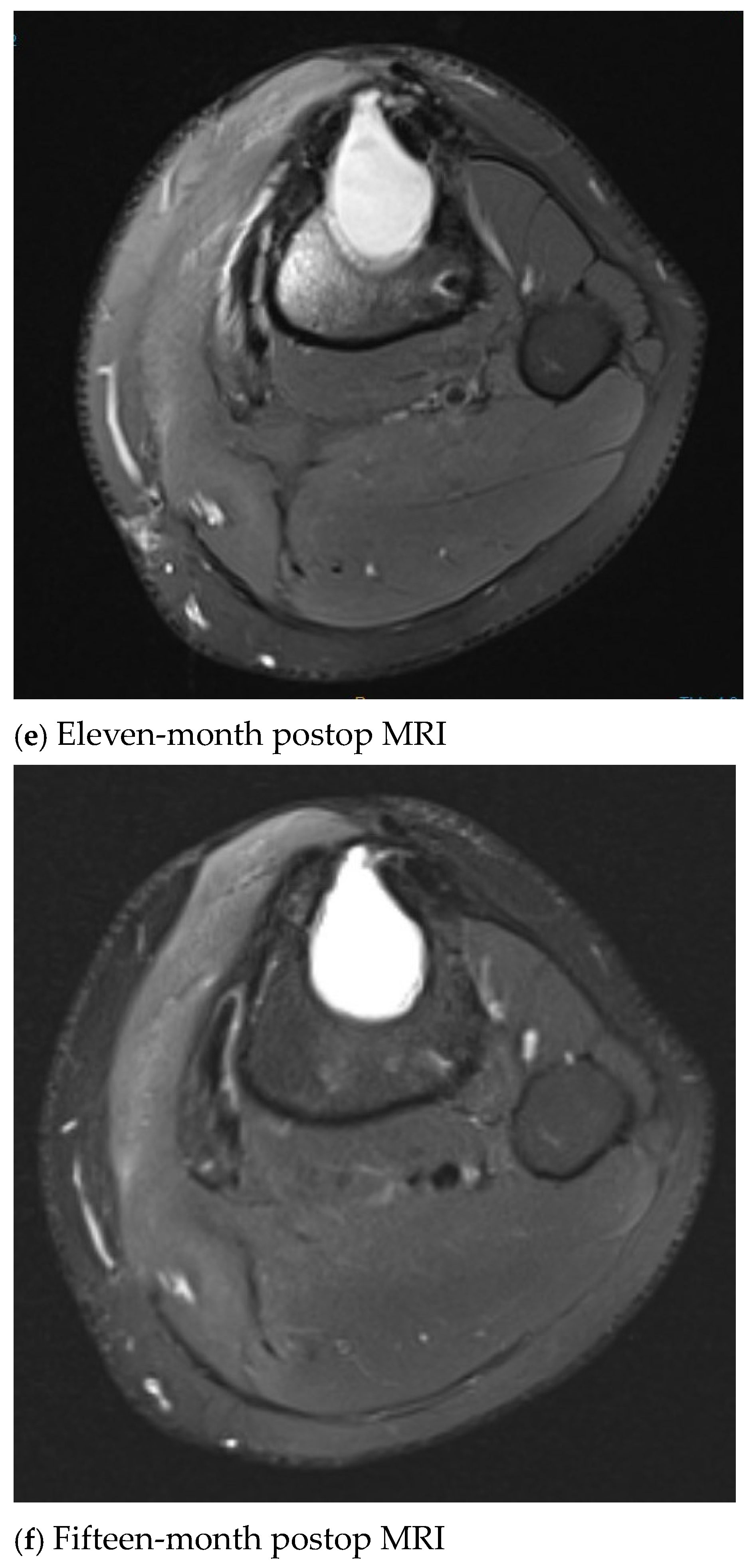 Antibiotics 13 01068 g001c