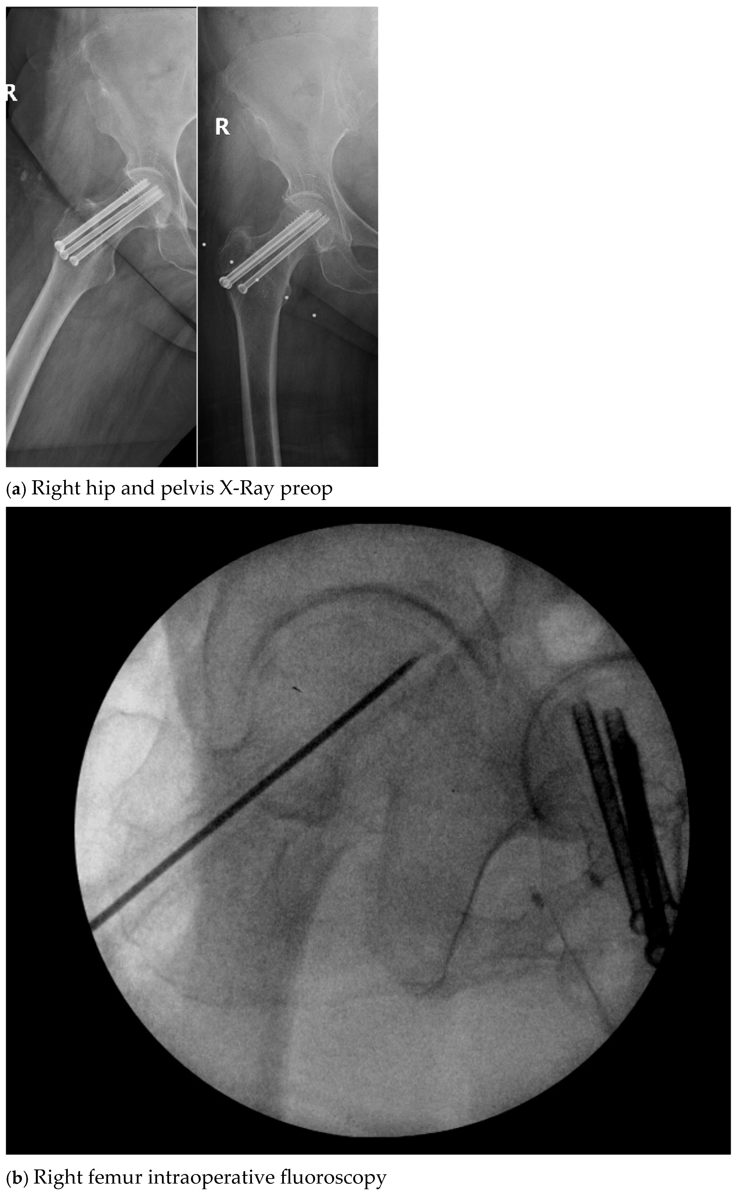 Antibiotics 13 01068 g002a