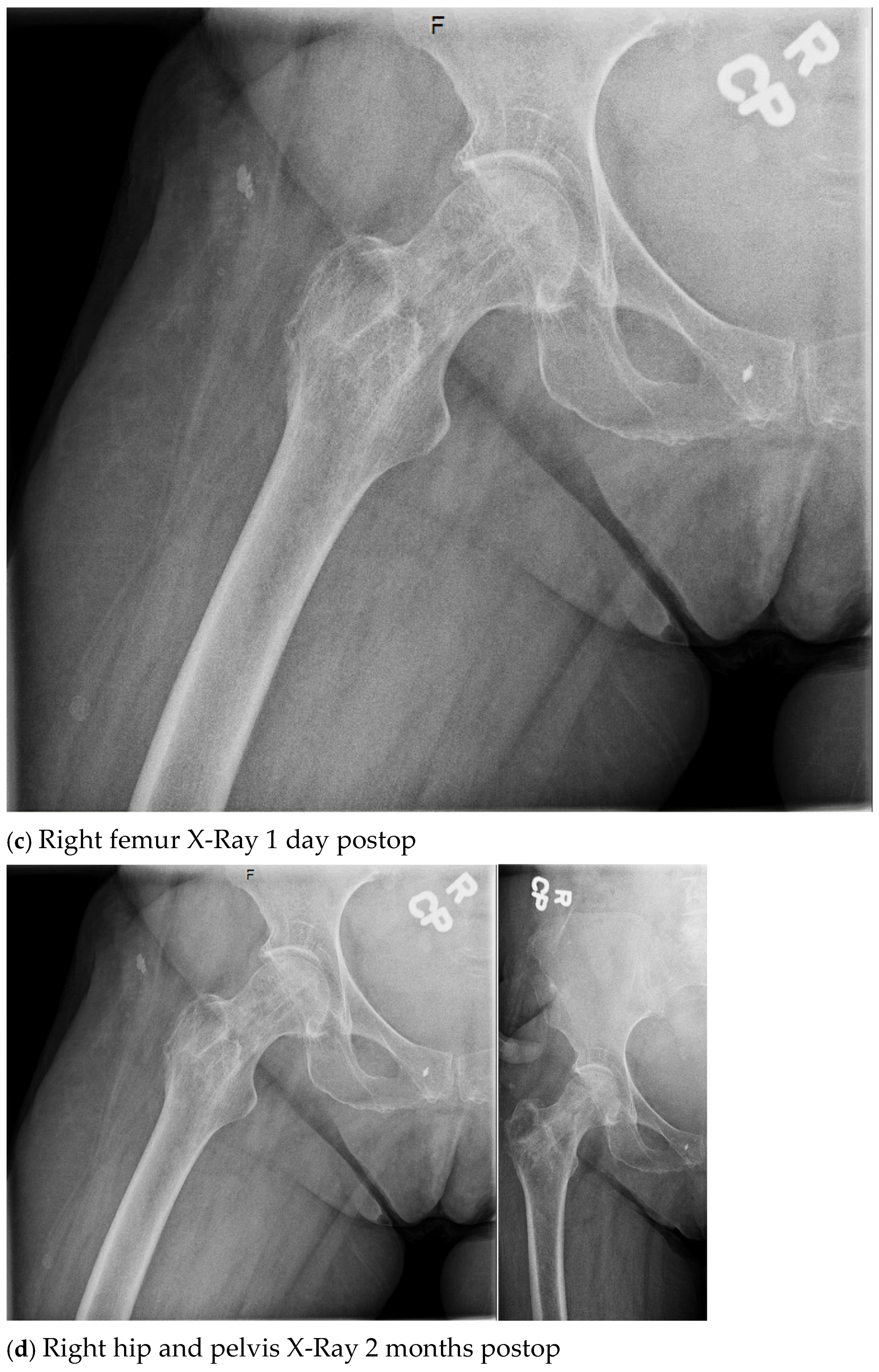 Antibiotics 13 01068 g002b