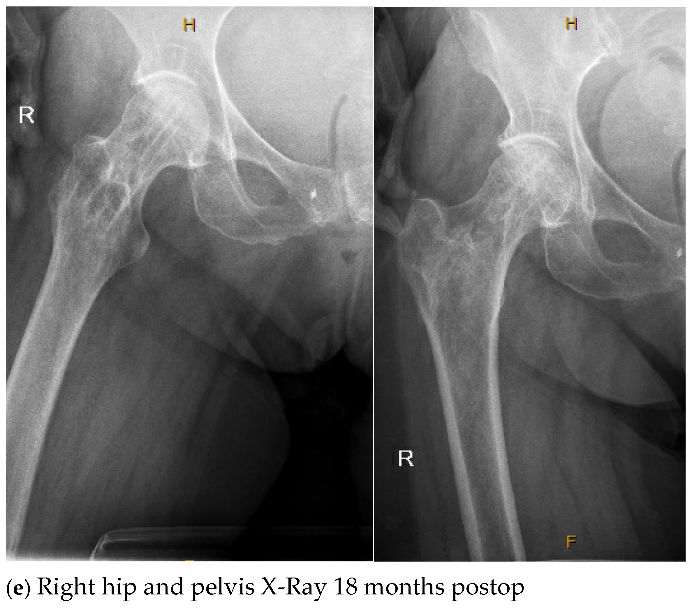 Antibiotics 13 01068 g002c