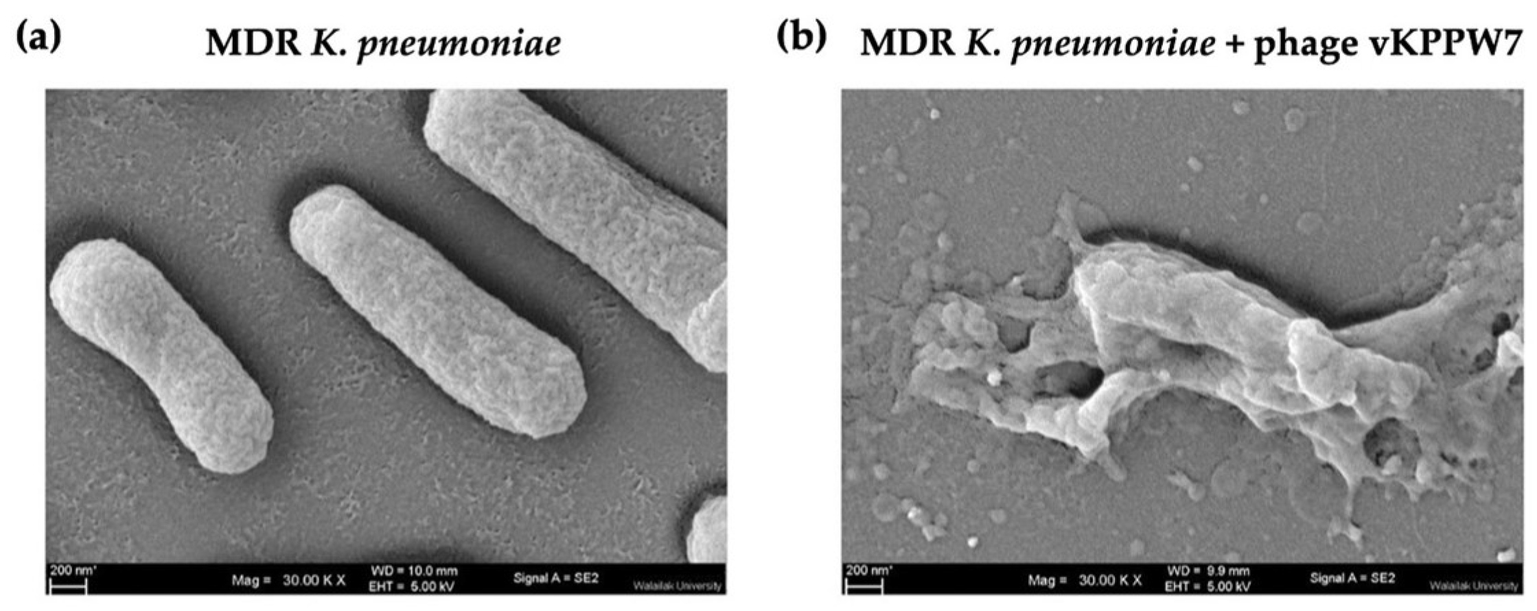 Antibiotics 14 00157 g003
