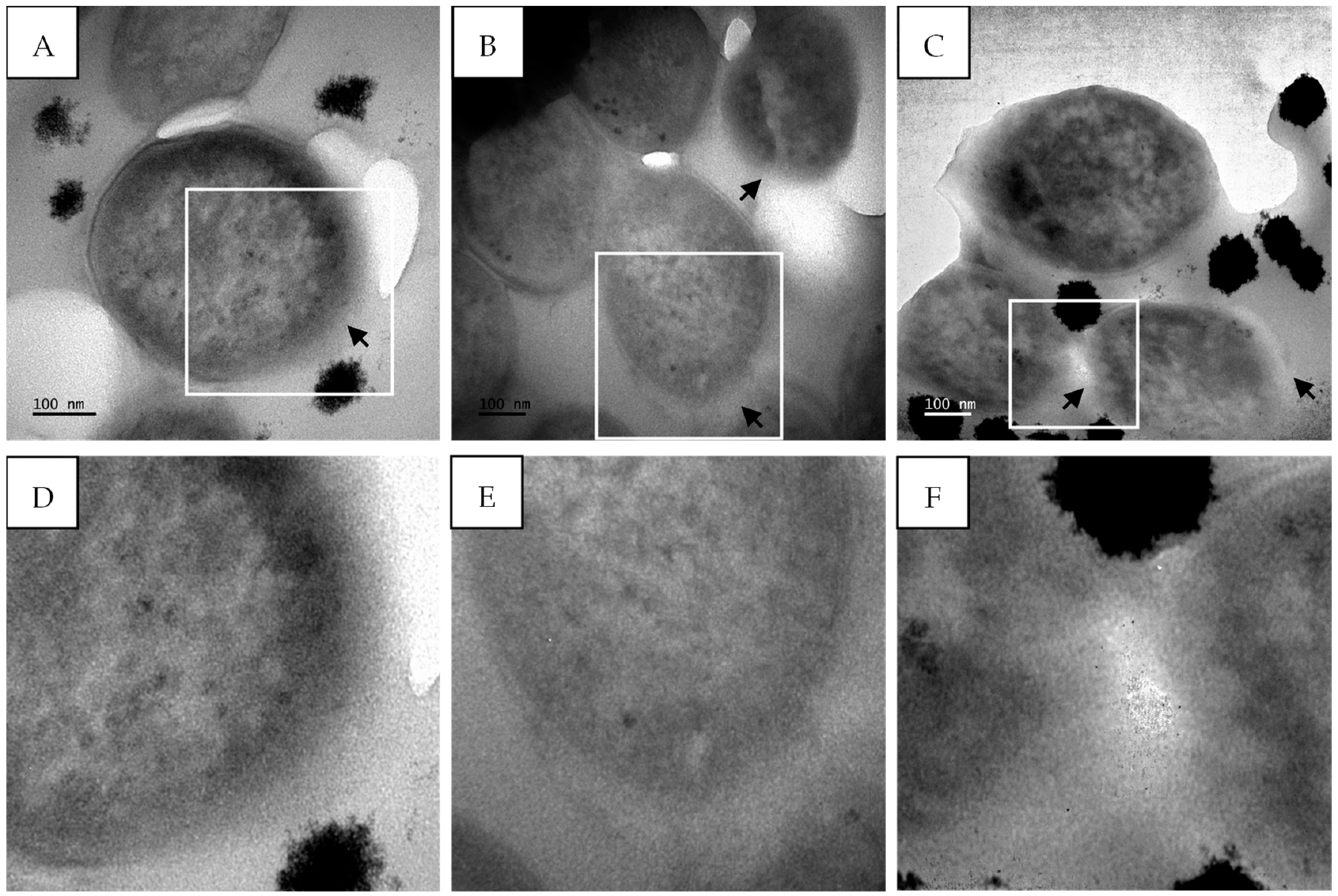 Antibiotics 14 00179 g012