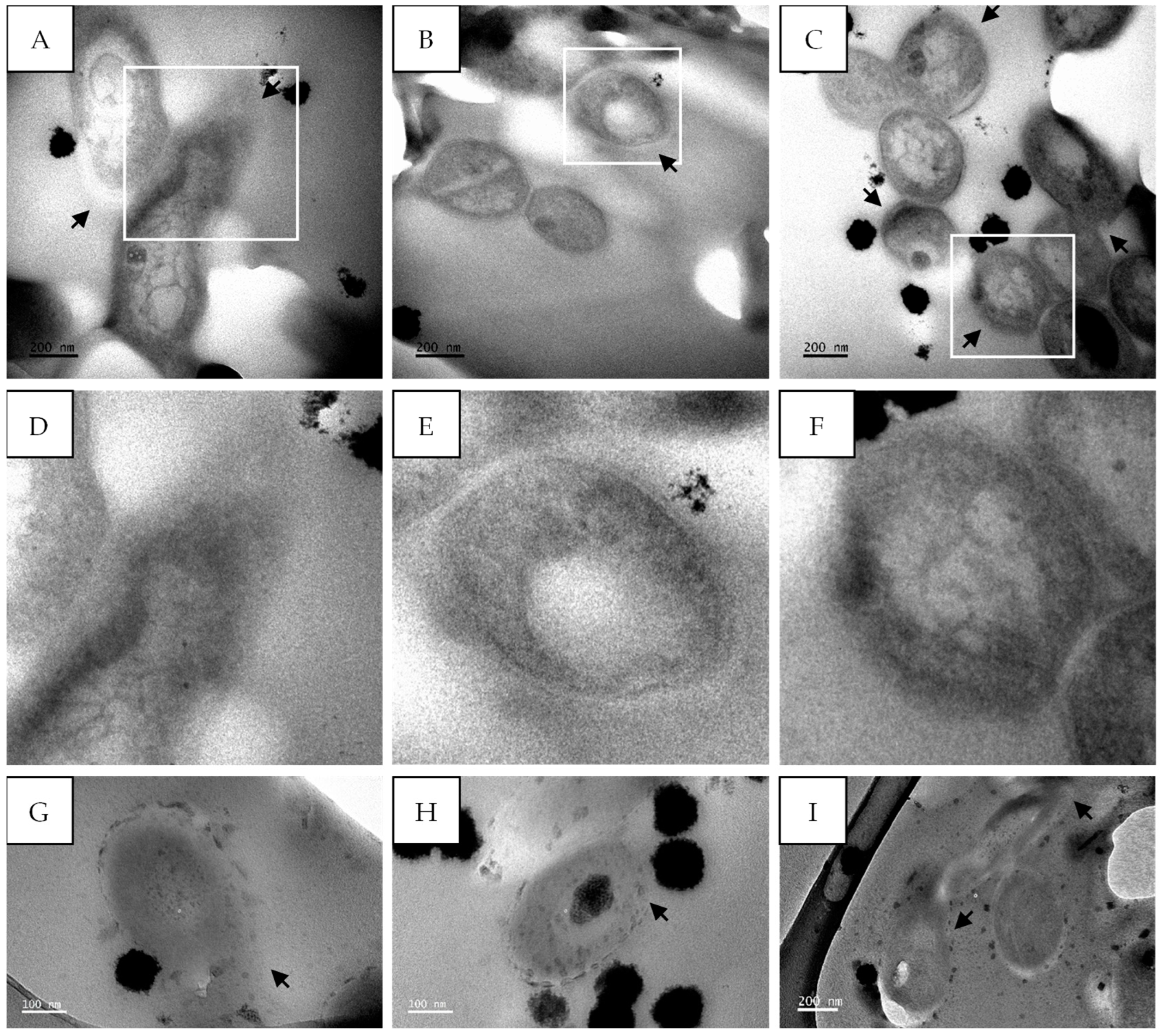Antibiotics 14 00179 g013