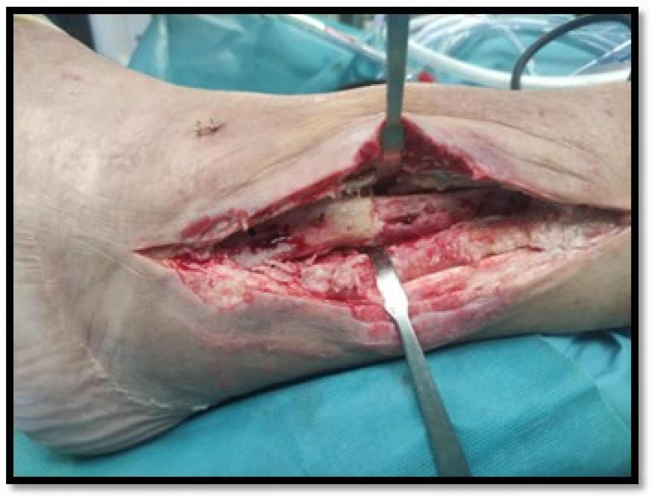 Antibiotics 14 00215 g002