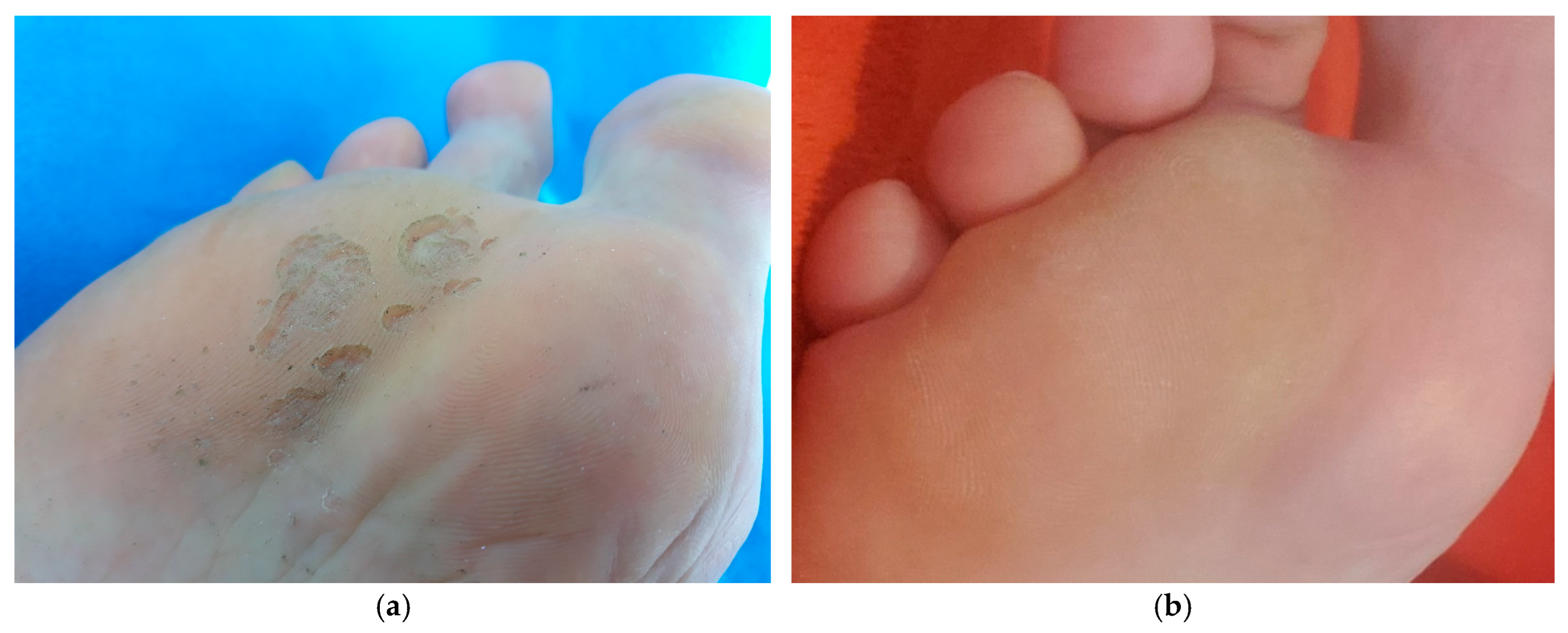 Antibiotics 14 00241 g004