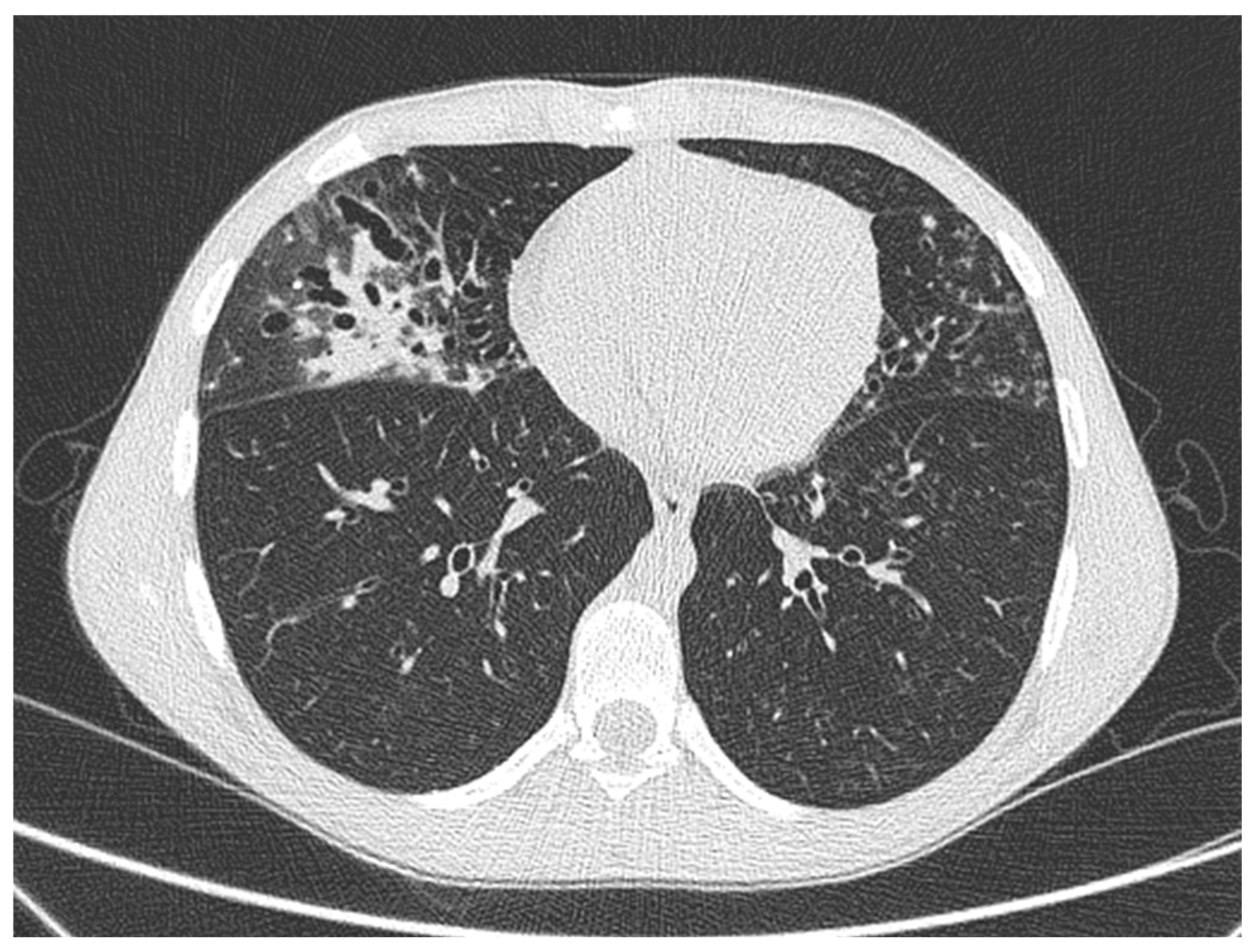 Antibiotics 14 00317 g003