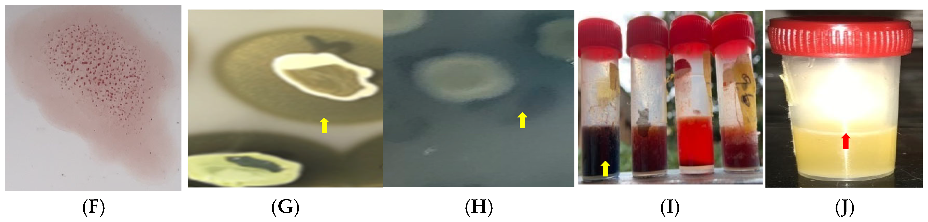 Antibiotics 14 00453 g002b