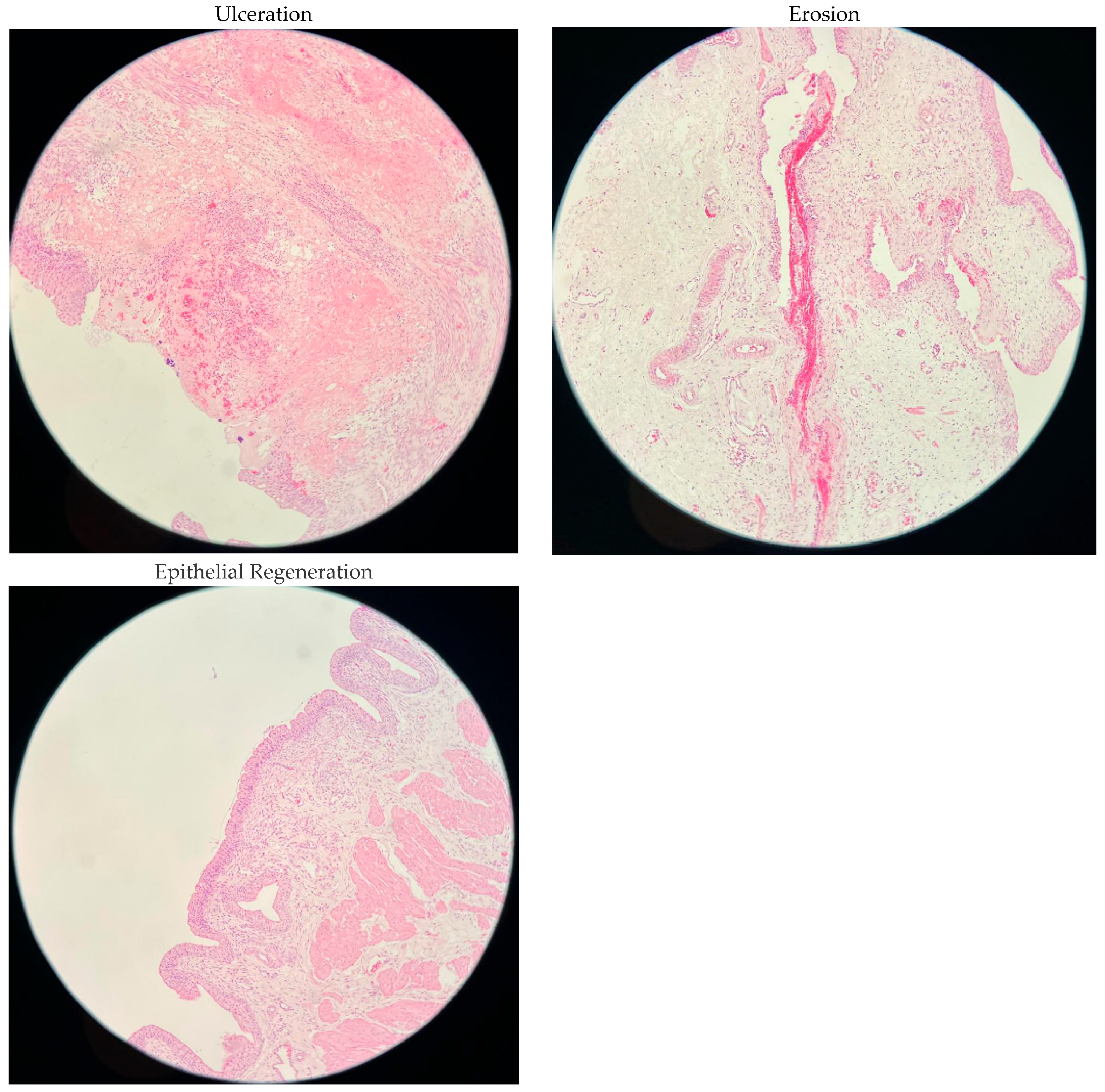 Antibiotics 14 00611 g001b