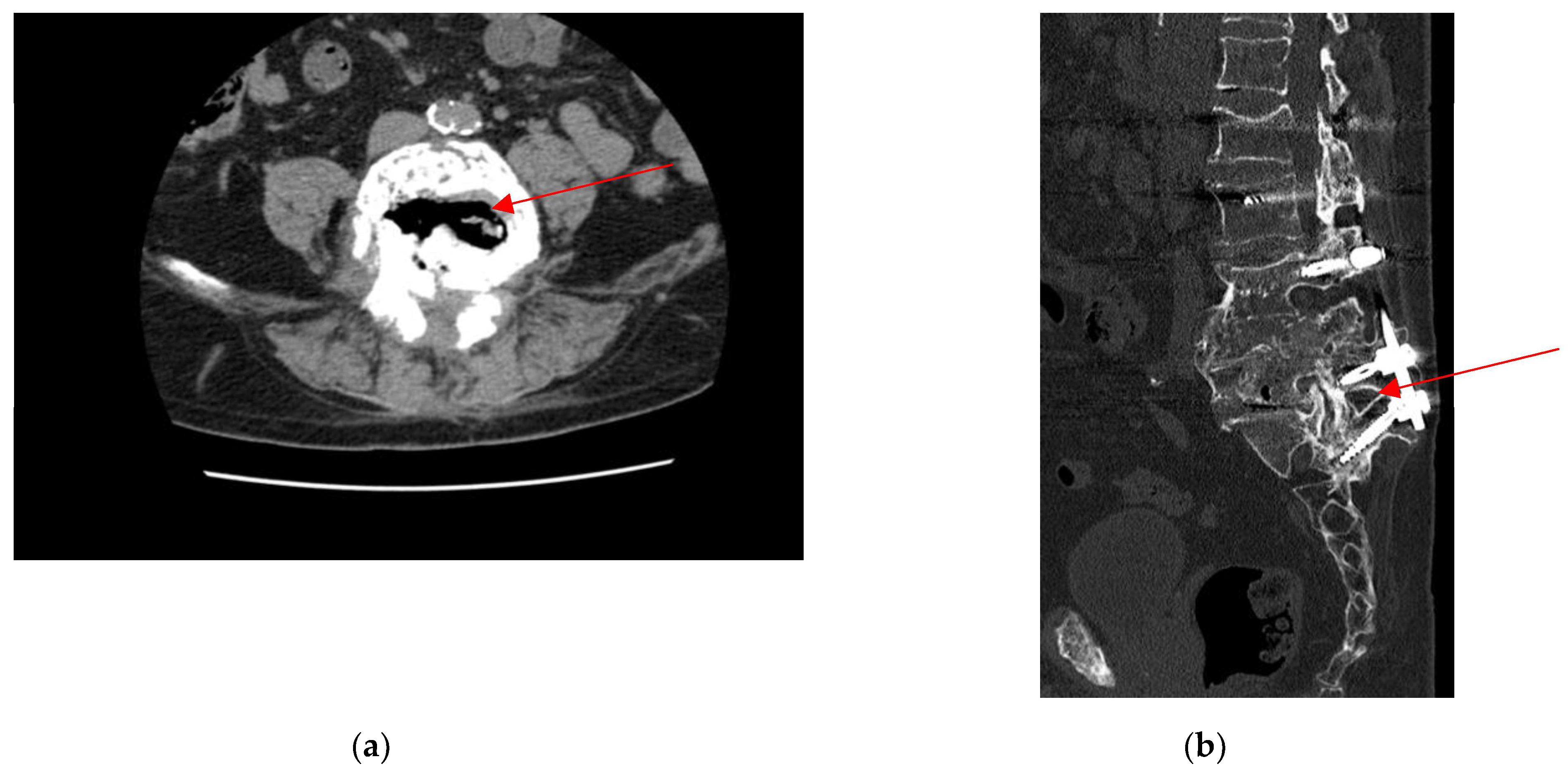 Antibiotics 14 00854 g001