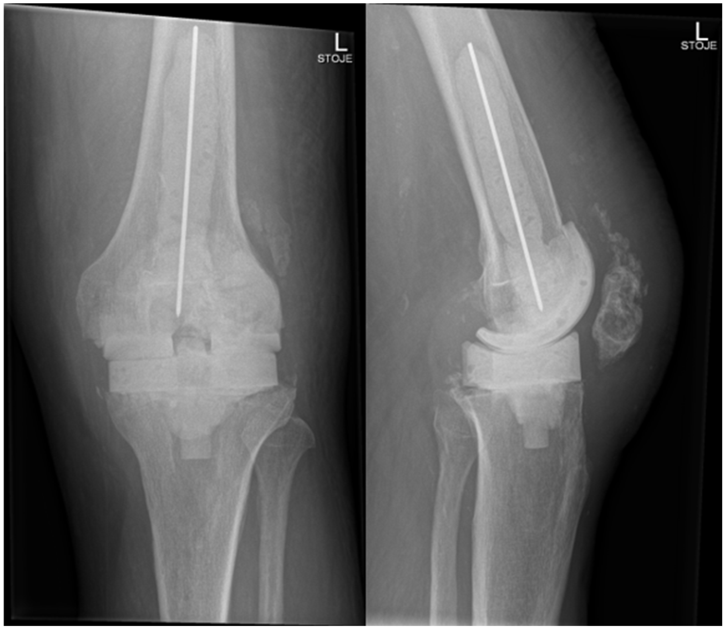 Antibiotics 14 01112 g004