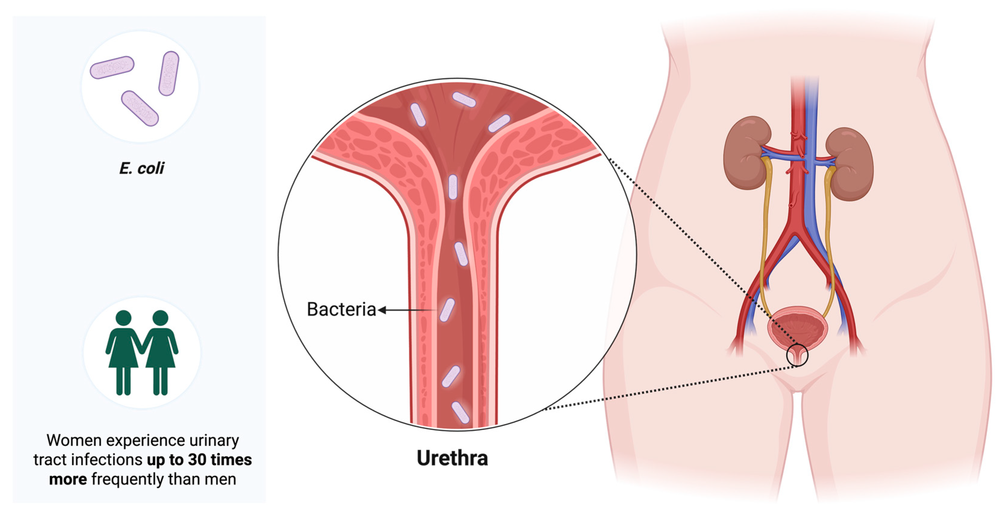 Antibiotics 14 01242 g001 Antibiotics 14 01242 g001
