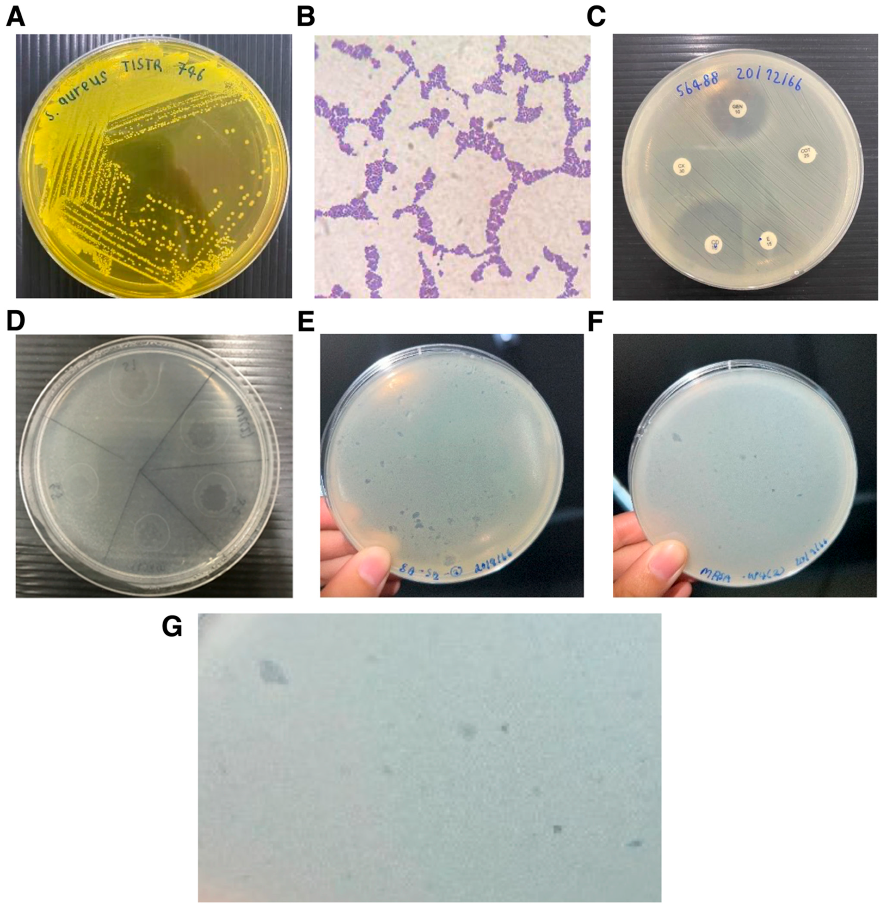 Antibiotics 15 00155 g001 Antibiotics 15 00155 g001