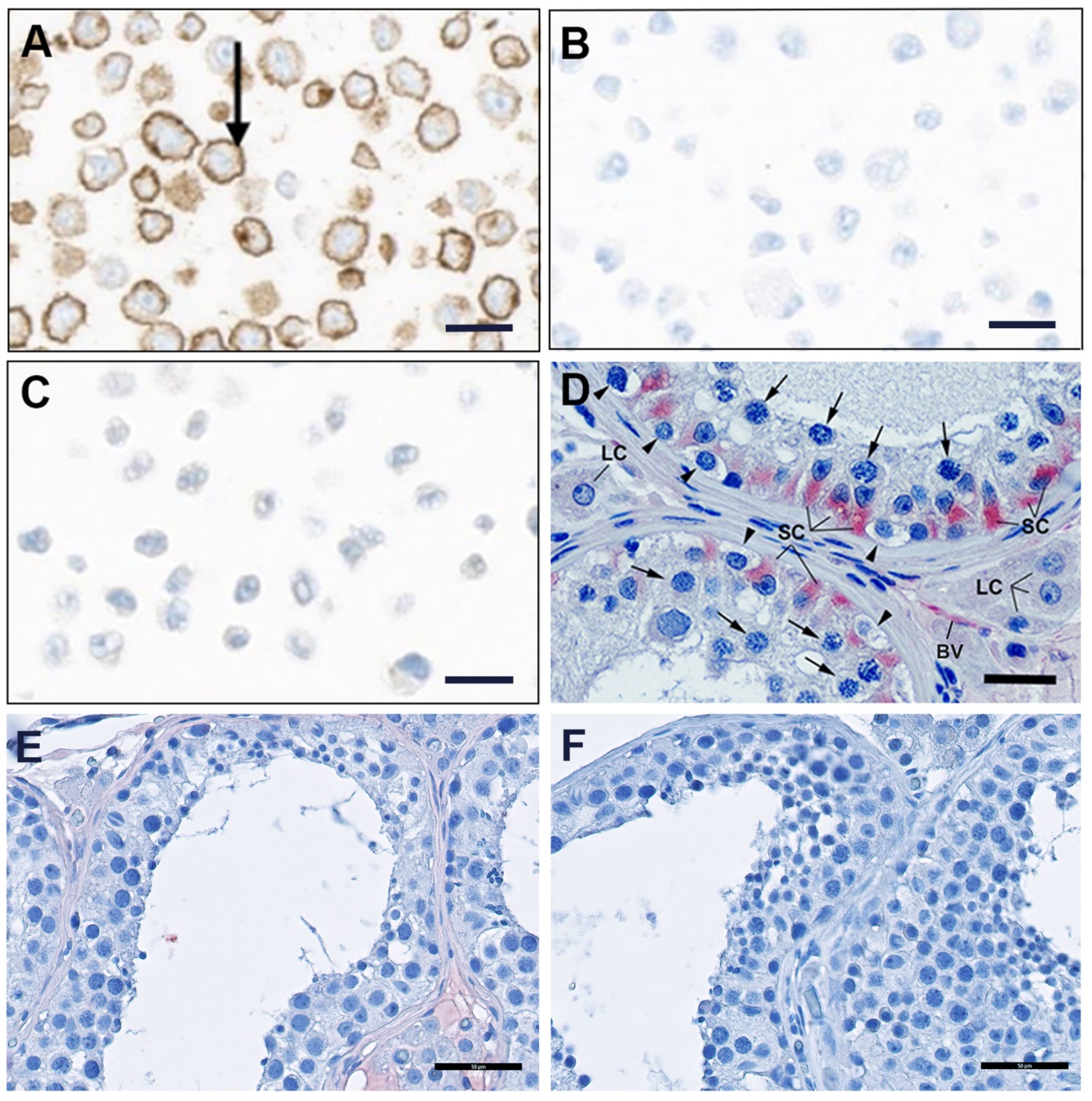 Antibodies 06 00015 g006