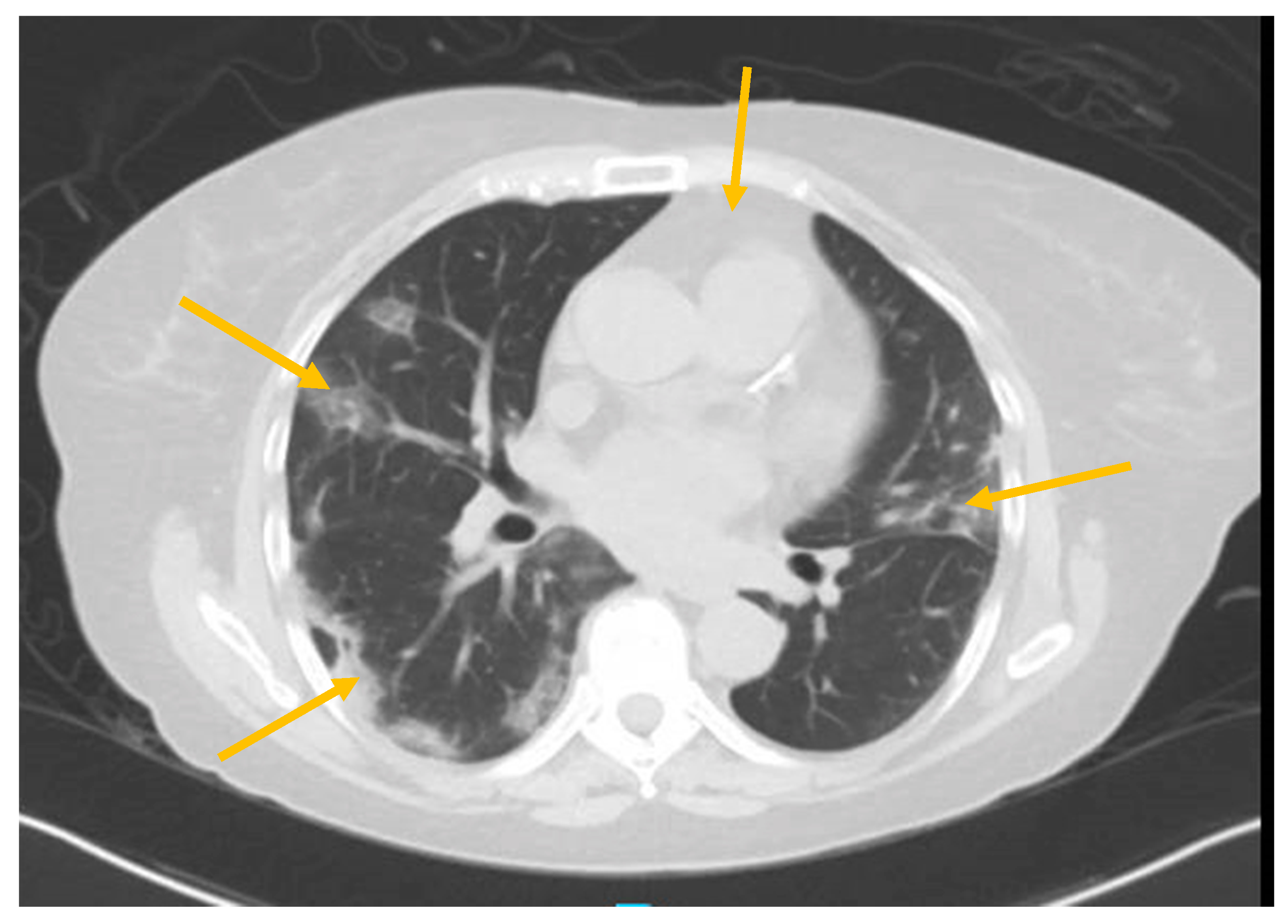 Antibodies 09 00042 g001 Antibodies 09 00042 g001
