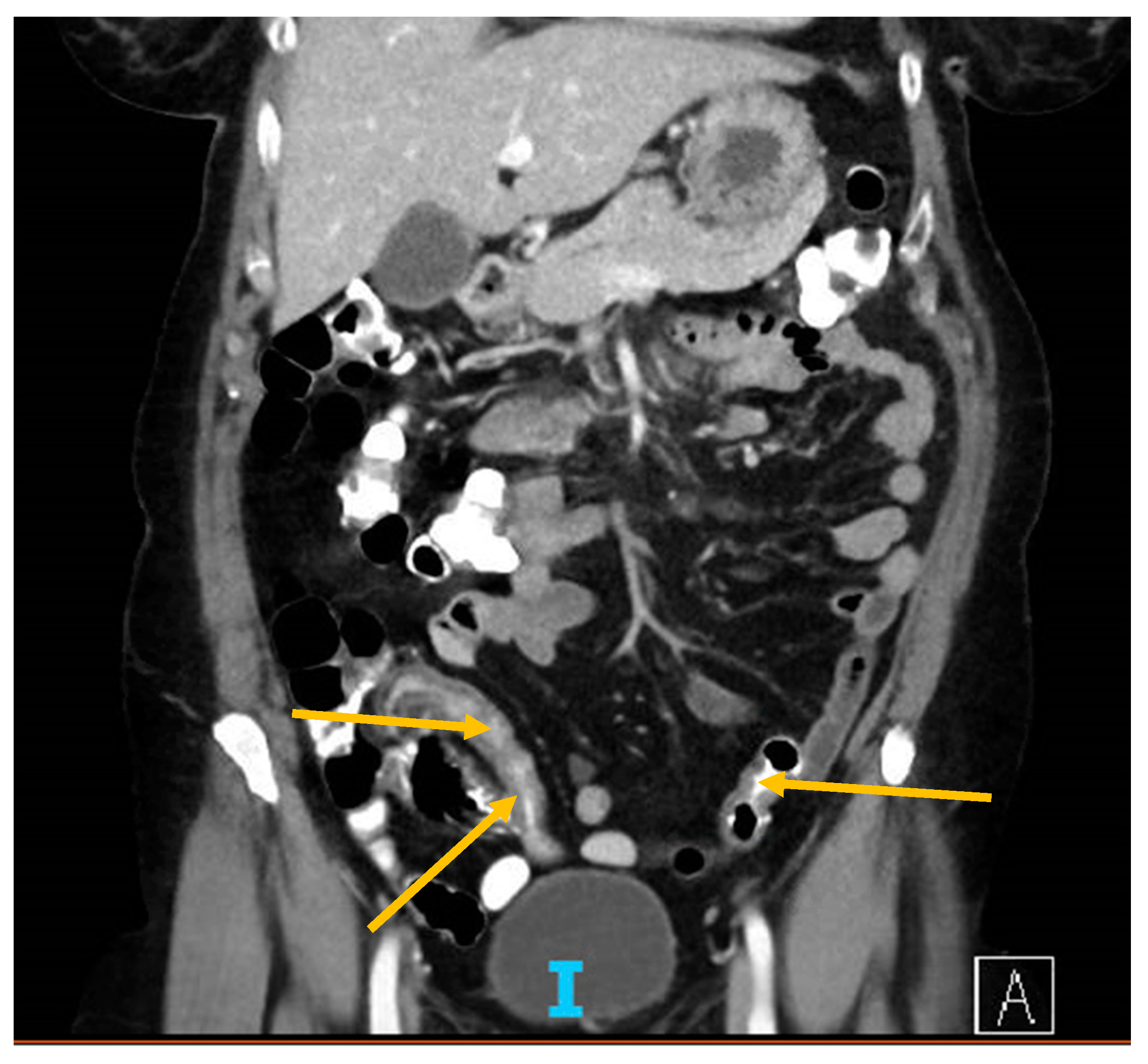 Antibodies 09 00042 g002 Antibodies 09 00042 g002