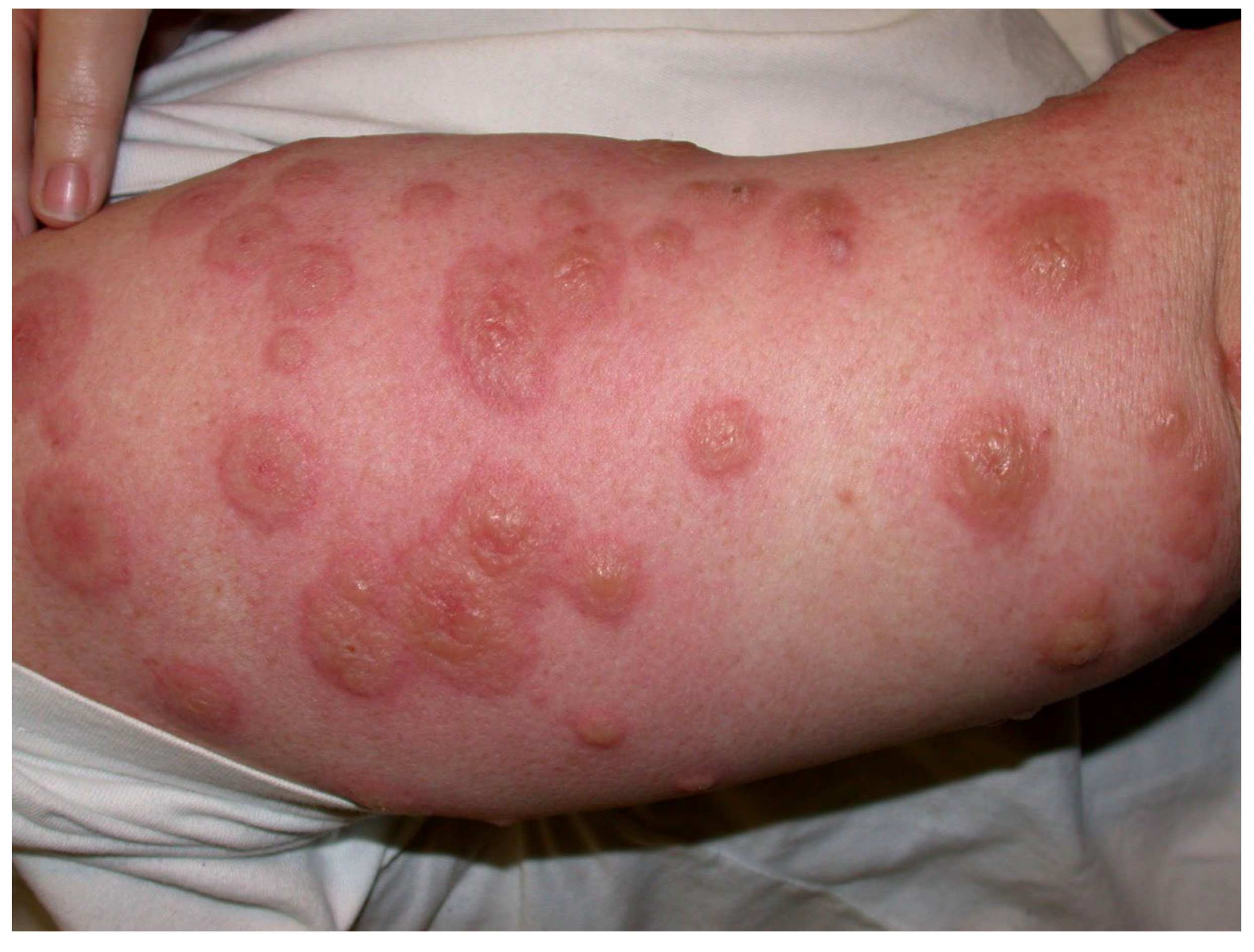 Antibodies 11 00017 g003