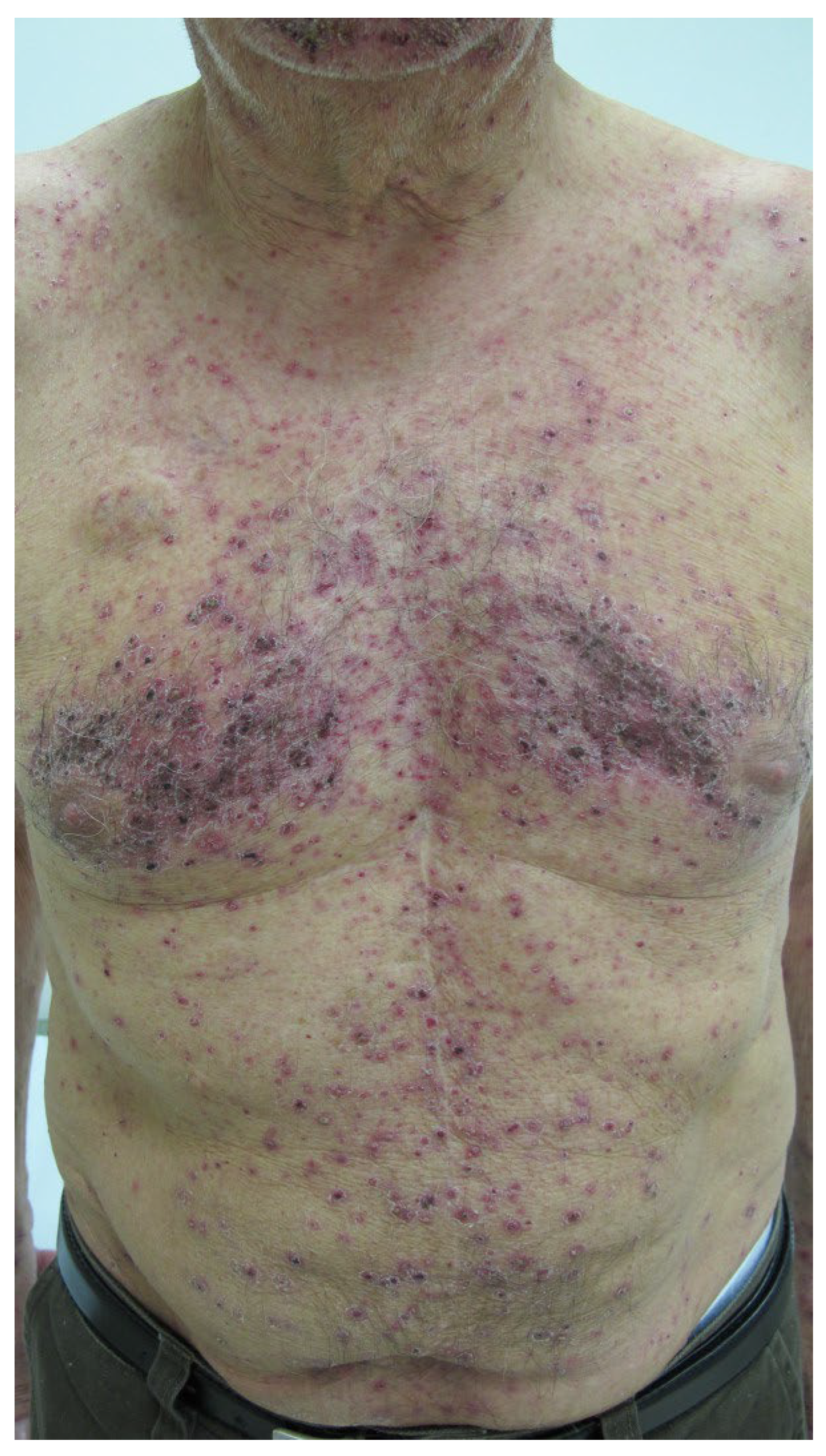 Antibodies 11 00017 g004