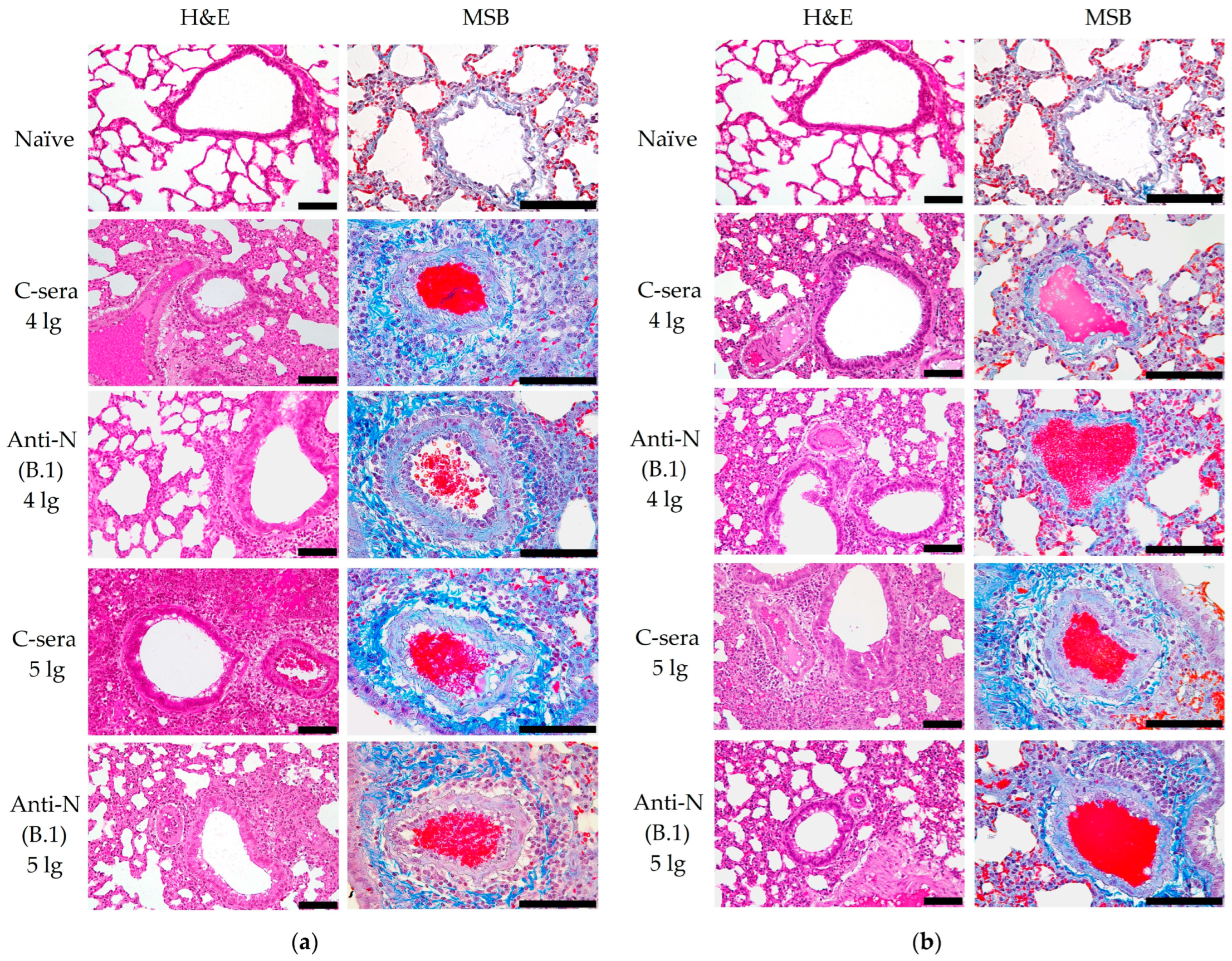 Antibodies 14 00045 g005