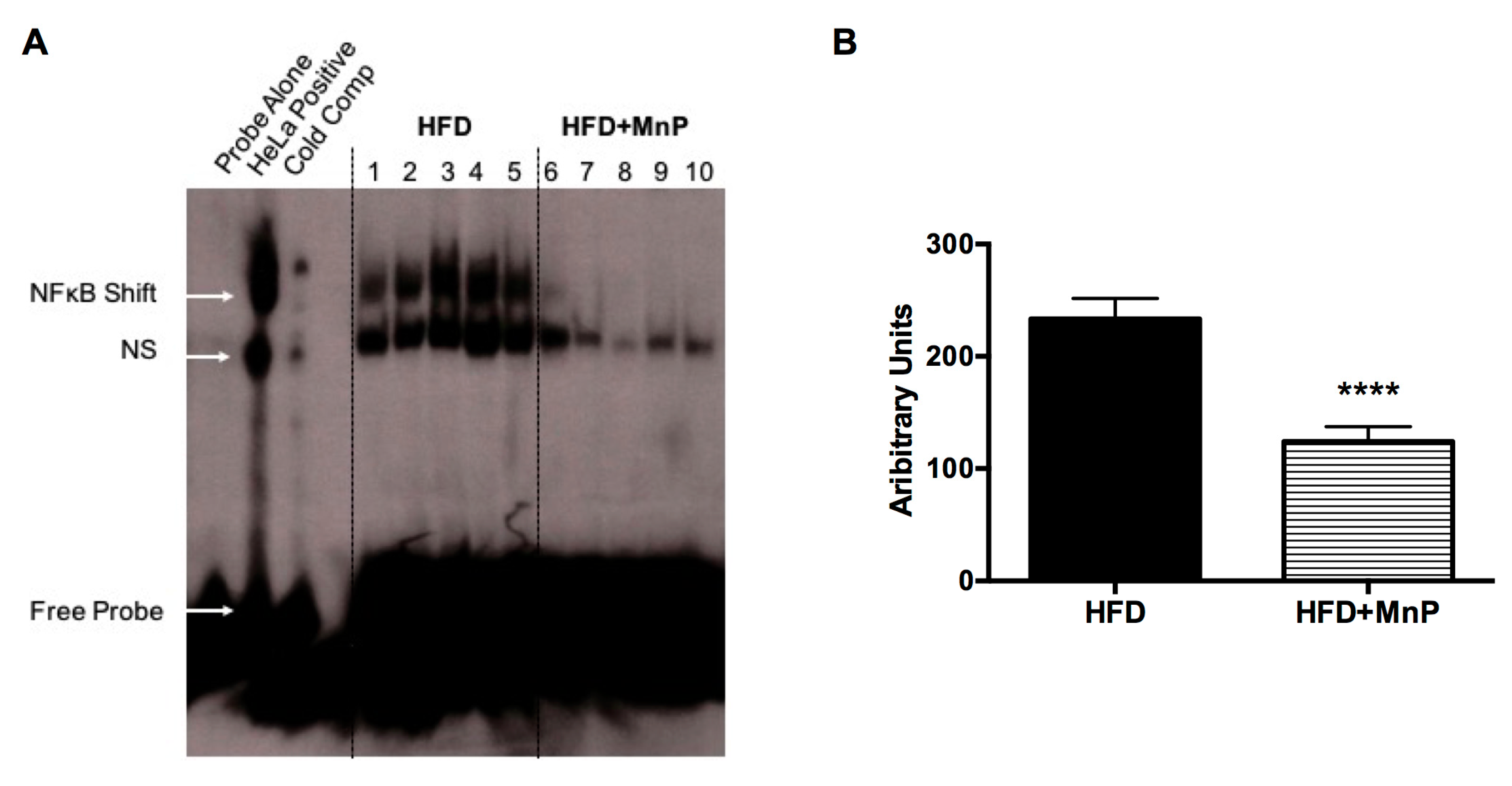 Antioxidants 06 00085 g008 Antioxidants 06 00085 g008
