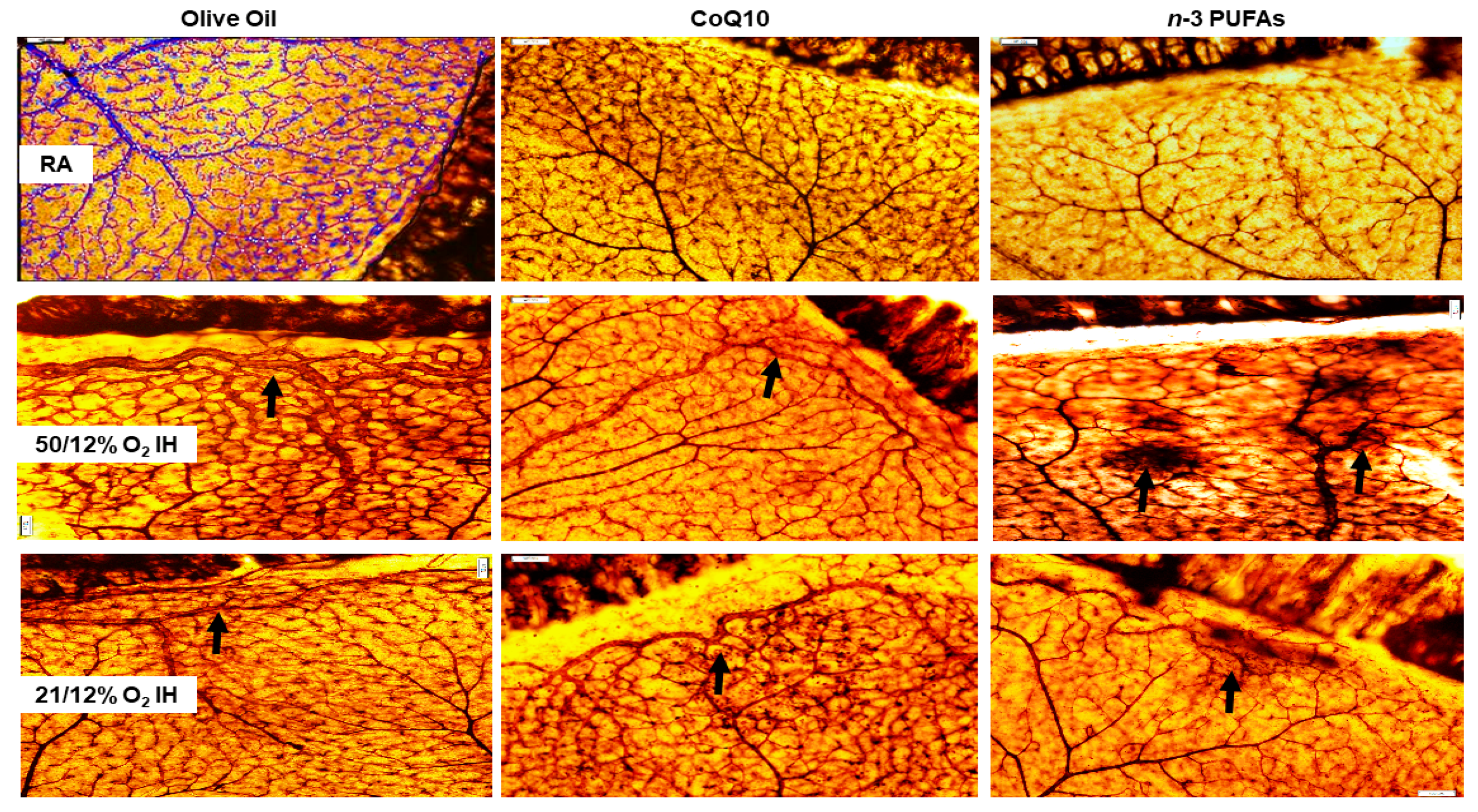 Antioxidants 07 00160 g004 Antioxidants 07 00160 g004