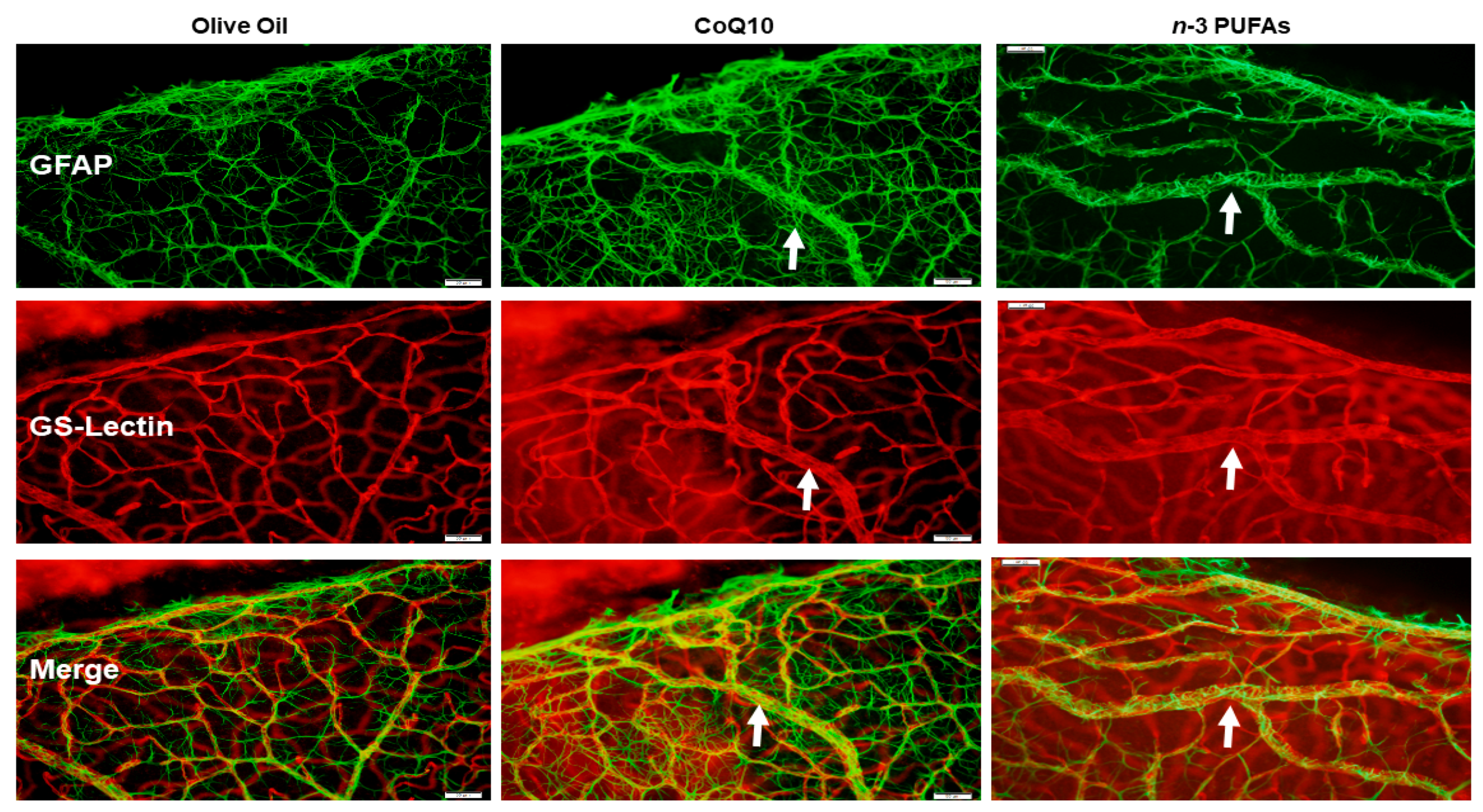 Antioxidants 07 00160 g005 Antioxidants 07 00160 g005