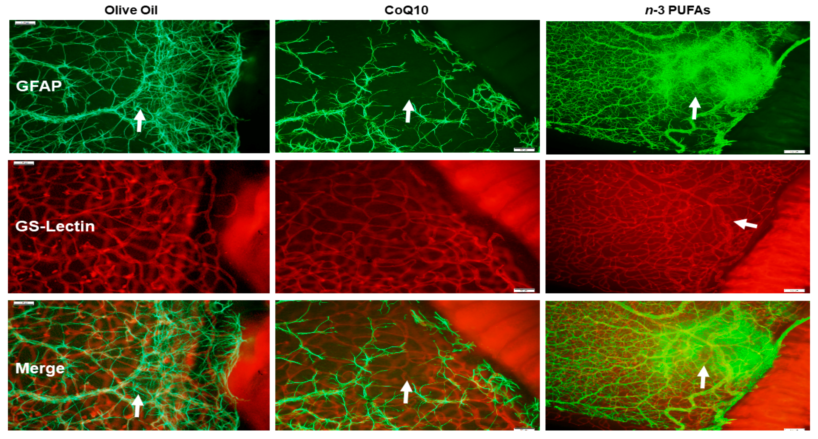 Antioxidants 07 00160 g006 Antioxidants 07 00160 g006