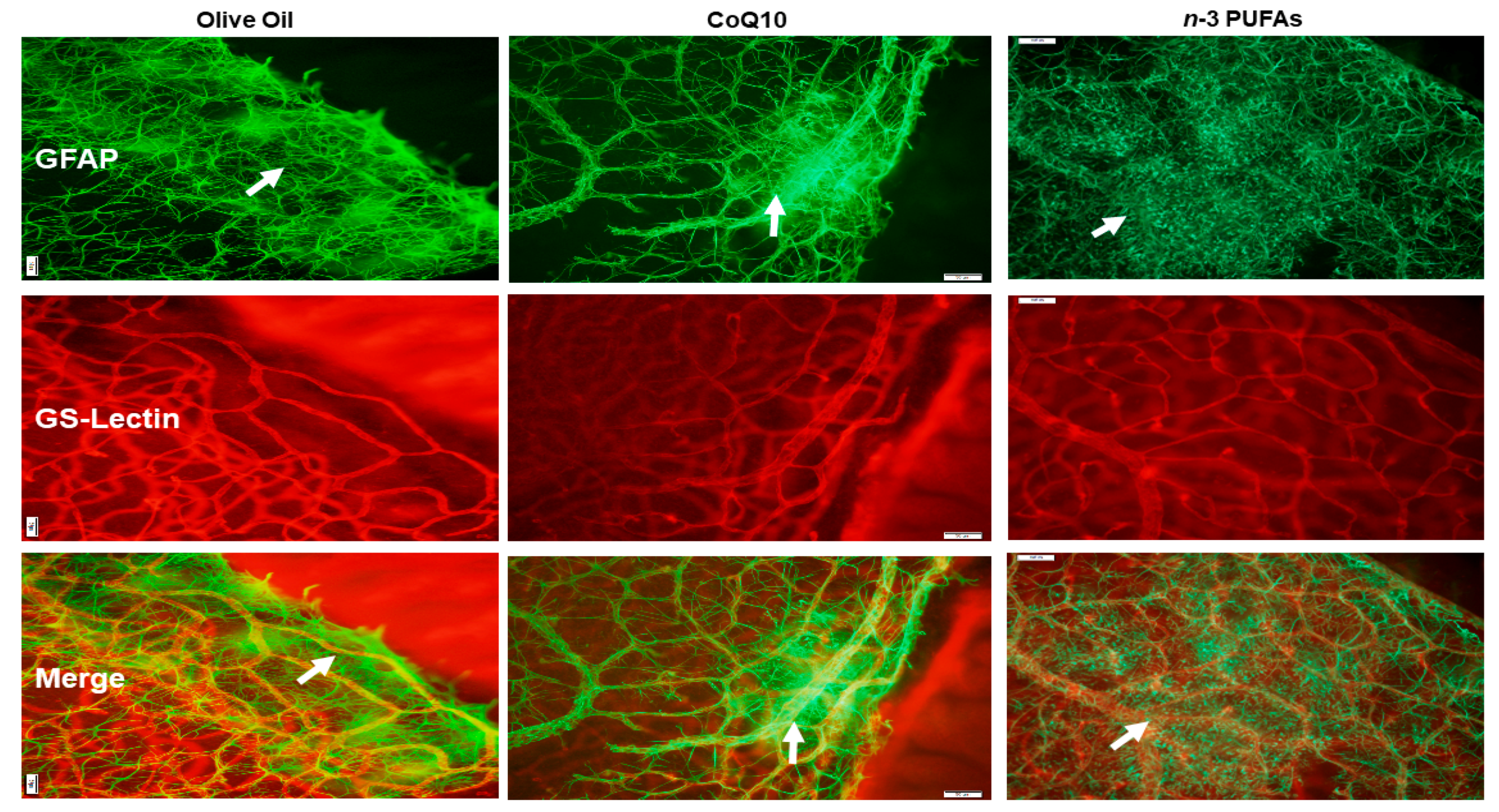 Antioxidants 07 00160 g007 Antioxidants 07 00160 g007