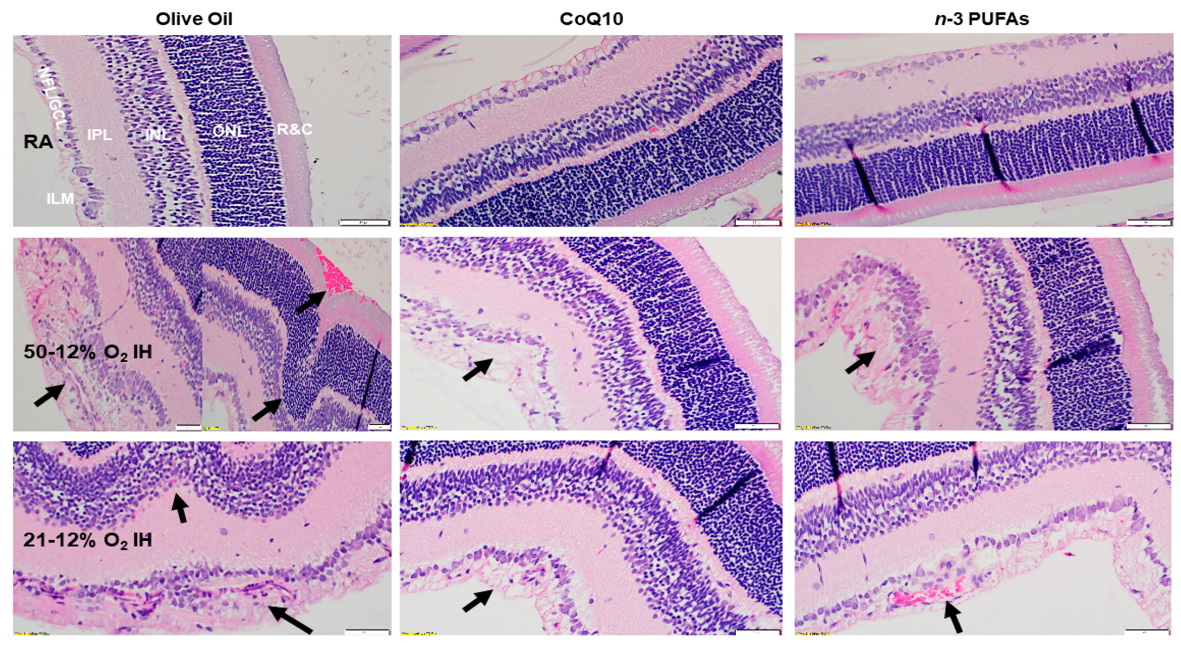 Antioxidants 07 00160 g008 Antioxidants 07 00160 g008