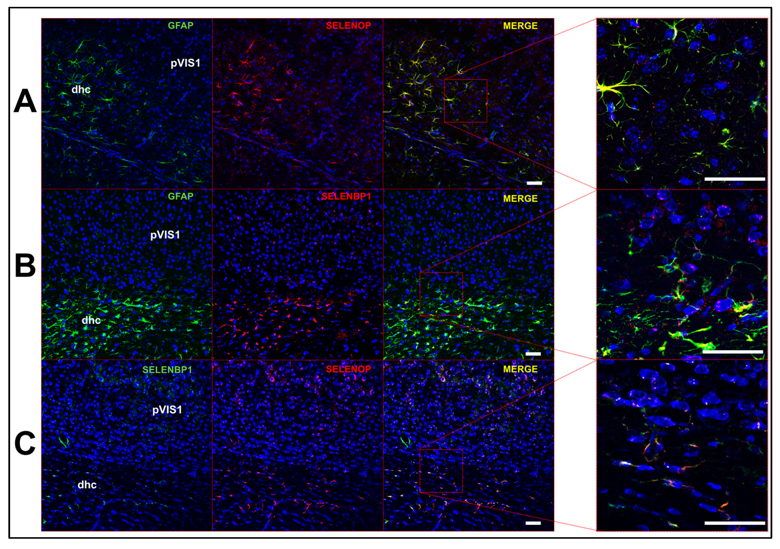 Antioxidants 08 00120 g003