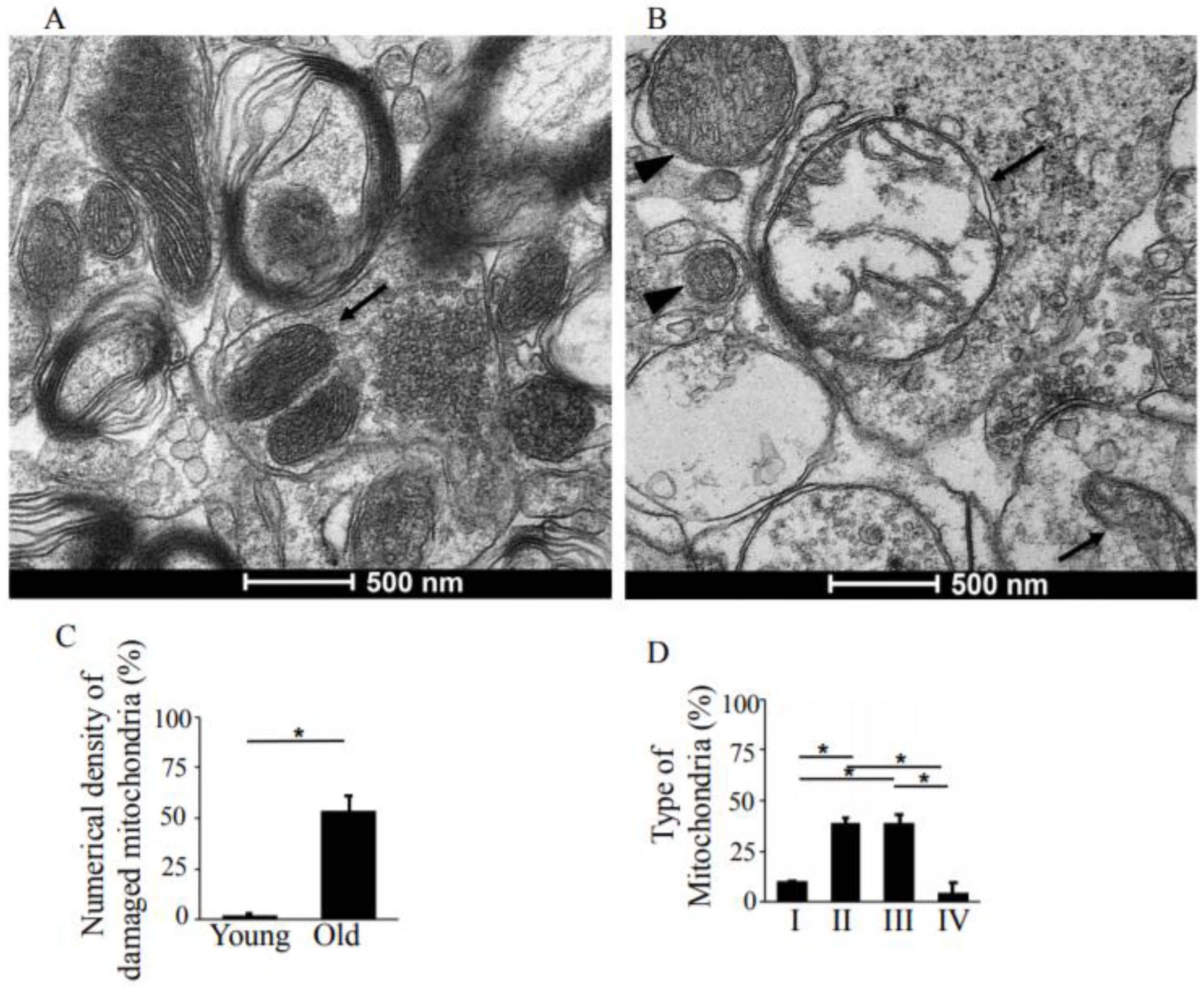 Antioxidants | Free Full-Text | Transmission Electron Microscopy Study